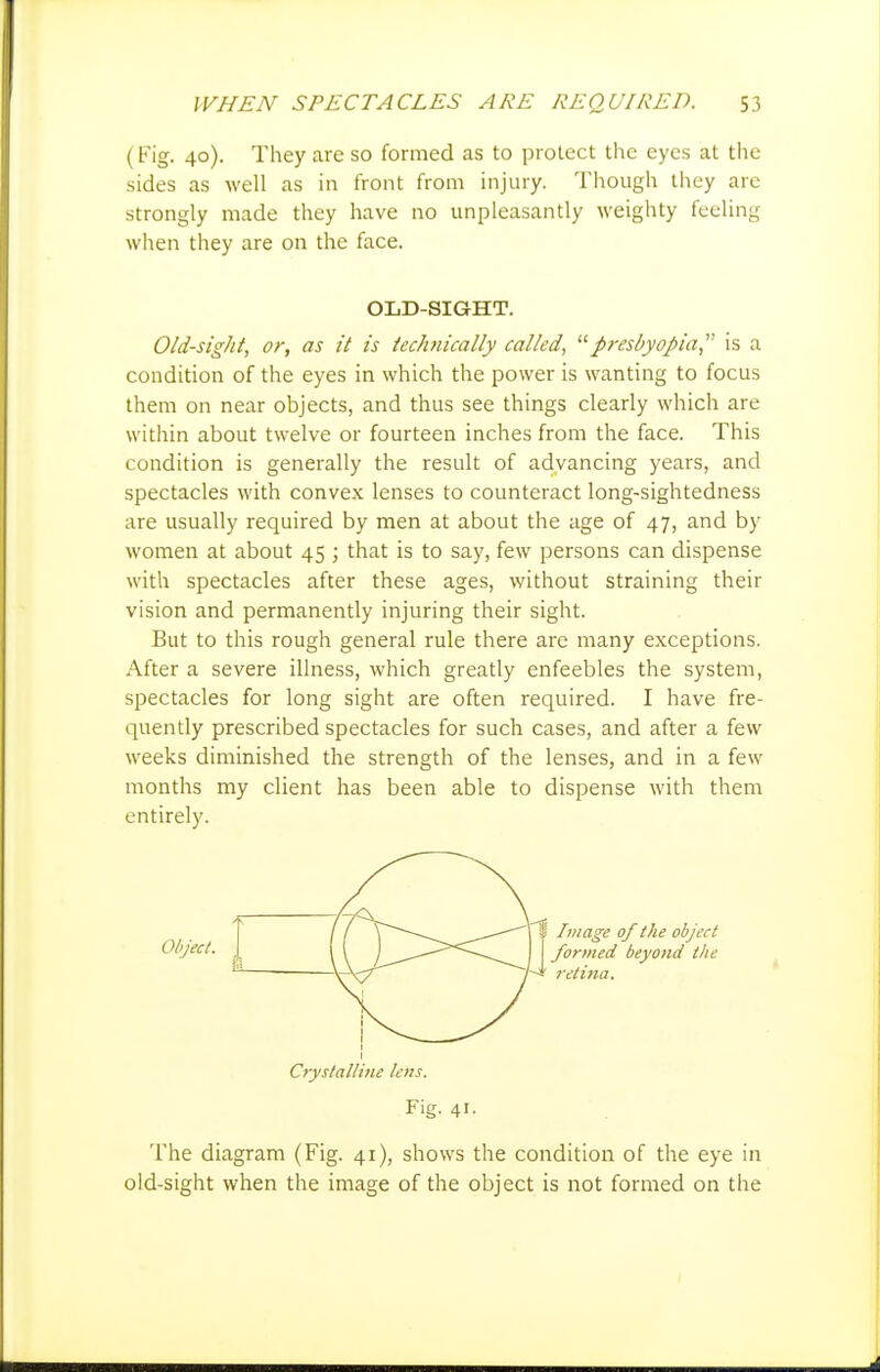 (Fig. 40). They are so formed as to protect the eyes at the sides as well as in front from injury. Though they are strongly made they have no unpleasantly weighty feeling when they are on the face. OLD-SIGHT. Old-sight, or, as it is techiically called, '■^presbyopia,'' is a condition of the eyes in which the power is wanting to focus them on near objects, and thus see things clearly which are within about twelve or fourteen inches from the face. This condition is generally the result of advancing years, and spectacles with convex lenses to counteract long-sightedness are usually required by men at about the age of 47, and by women at about 45 ; that is to say, few persons can dispense with spectacles after these ages, without straining their vision and permanently injuring their sight. But to this rough general rule there are many exceptions. After a severe illness, which greatly enfeebles the system, spectacles for long sight are often required. I have fre- quently prescribed spectacles for such cases, and after a few weeks diminished the strength of the lenses, and in a few months my client has been able to dispense with them entirely. Cryslallitie lens. Fig. 41. The diagram (Fig. 41), shows the condition of the eye in old-sight when the image of the object is not formed on the