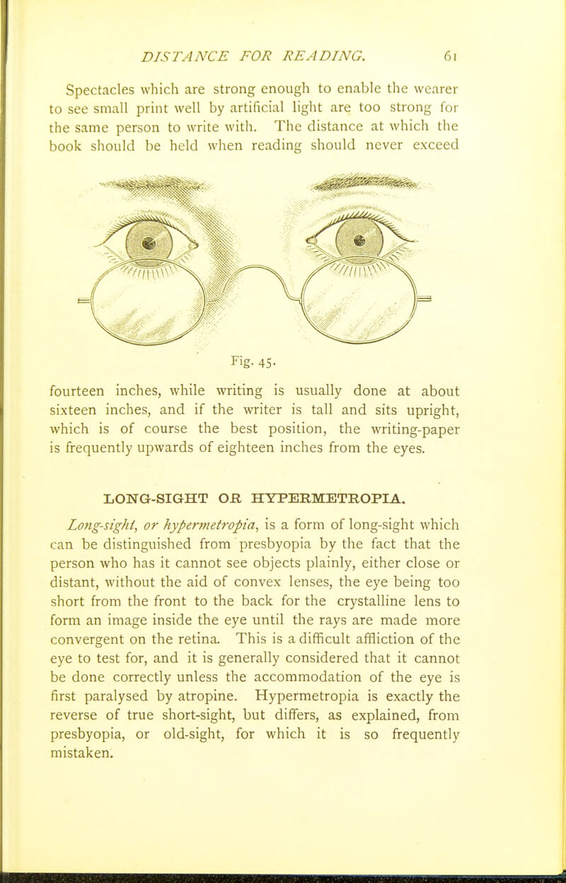 Spectacles which are strong enough to enable the wearer to see small print well by artificial light are too strong for the same person to write with. The distance at which the book should be held when reading should never exceed Fig- 45- fourteen inches, while writing is usually done at about sixteen inches, and if the writer is tall and sits upright, which is of course the best position, the writing-paper is frequently upwards of eighteen inches from the eyes. LONG-SIGHT OH HYPEE.METROPIA. Long-sighl, or hypermetropia, is a form of long-sight which can be distinguished from presbyopia by the fact that the person who has it cannot see objects plainly, either close or distant, without the aid of convex lenses, the eye being too short from the front to the back for the crystalline lens to form an image inside the eye until the rays are made more convergent on the retina. This is a difficult affliction of the eye to test for, and it is generally considered that it cannot be done correctly unless the accommodation of the eye is first paralysed by atropine. Hypermetropia is exactly the reverse of true short-sight, but differs, as explained, from presbyopia, or old-sight, for which it is so frequently mistaken.