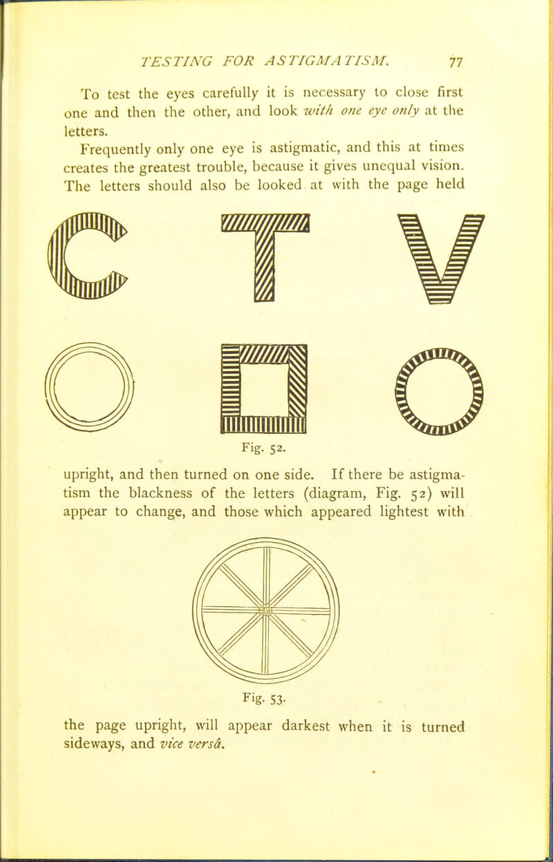 To test the eyes carefully it is necessary to close first one and then the other, and look u'il/i one eye otUy at the letters. Frequently only one eye is astigmatic, and this at times creates the greatest trouble, because it gives unequal vision. The letters should also be looked at with the page held 1 Fig. 52. upright, and then turned on one side. If there be astigma- tism the blackness of the letters (diagram, Fig. 52) will appear to change, and those which appeared lightest with Fig. S3- the page upright, will appear darkest when it is turned sideways, and vice versa.