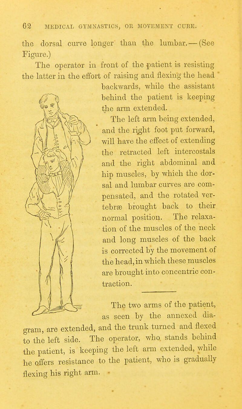 the dorsal curve longer than the lumbar. — (See Figure.) The operator in front of the patient is resisting the latter in the effort of raising and flexing the head ' backwards, while the assistant behind the patient is keeping the arm extended. The left arm being extended, and the ri^ht foot put forward, will have the effect of extending the retracted left intercostals and the right abdominal and hip muscles, by which the dor- sal and lumbar curves are com- pensated, and the rotated ver- tebrae brought back to their normal position. The relaxa- tion of the muscles of the neck and long muscles of the back is corrected by the movement of the head, in which these muscles are brought into concentric con- traction. The two arms of the patient, as seen by the annexed dia- gram, are extended, and the trunk turned and flexed to the left side. The operator, who, stands behind the patient, is keeping the left arm extended, while he offers resistance to the patient, who is gradually flexing his right arm. •