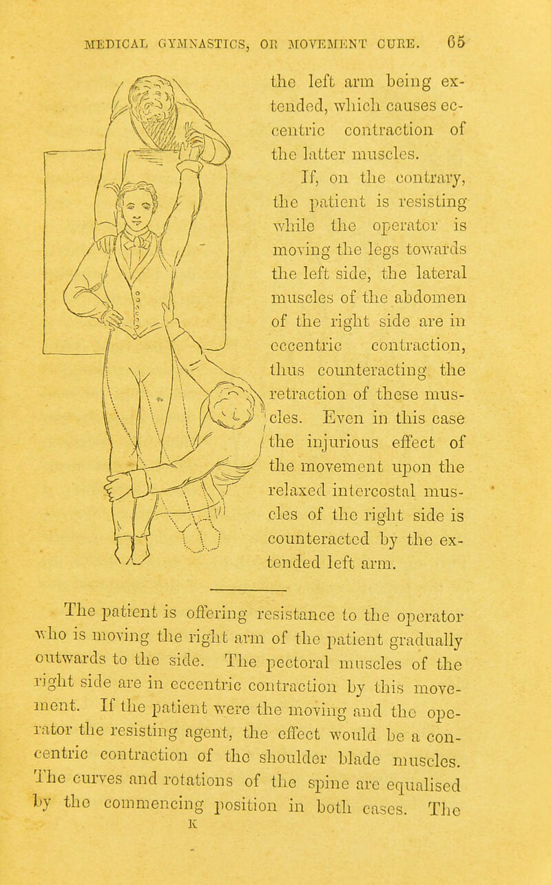 the left arm being ex- tended, wliicli causes ec- centric contraction of the latter muscles. If, on the contrary, the patient is resisting while the operator is moving the legs towards the left side, the lateral muscles of the abdomen of the right side are in eccentric contraction, thus counteracting the retraction of these mus- Even in this case I the injurious effect of the movement U2Don the relaxed intercostal mus- cles of the right side is counteracted by the ex- tended left arm. The patient is offering resistance to the operator who is moving the right arm of the patient gradually outwards to the side. The pectoral muscles of the right side are in eccentric contraction by this move- ment. If the patient were the moving and the ope- rator the resisting agent, the effect would be a con- centric contraction of the shoulder blade muscles. The curves and rotations of the spine are equalised by the commencing position in both cases. The K