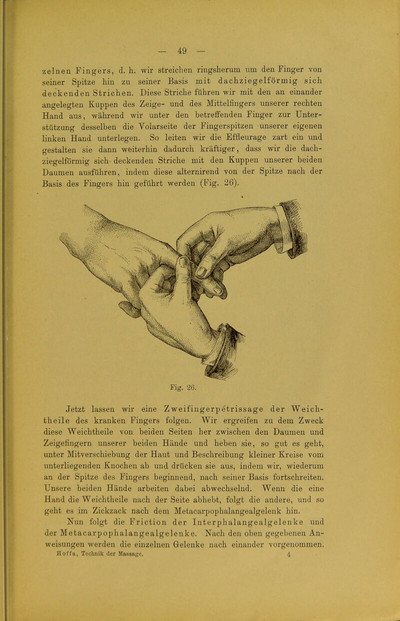 zelnen Fingers, d. h. wir streichen ringsherum um den Finger von seiner Spitze hin zu seiner Basis mit dachziegelförmig sich deckenden Strichen. Diese Striche führen wir mit den an einander angelegten Kuppen des Zeige- und des Mittelfingers unserer rechten Hand aus, während wir unter den betreffenden Finger zur Unter- stützung desselben die Volarseite der Fingerspitzen unserer eigenen linken Hand unterlegen. So leiten wir die Effleurage zart ein und gestalten sie dann weiterhin dadurch kräftiger, dass wir die dach- ziegelförmig sich deckenden Striche mit den Kuppen unserer beiden Daumen ausführen, indem diese alternirend von der Spitze nach der Basis des Fingers hin geführt werden (Fig. 26). Jetzt lassen wir eine Zweifingerpetrissage der Weich- theile des kranken Fingers folgen. Wir ergreifen zu dem Zweck diese Weichtheile von beiden Seiten her zwischen den Daumen und Zeigefingern unserer beiden Hände und heben sie, so gut es geht, unter Mitverschiebung der Haut und Beschreibung kleiner Kreise vom unterliegenden Knochen ab und drücken sie aus, indem wir, wiederum an der Spitze des Fingers beginnend, nach seiner Basis fortschreiten. Unsere beiden Hände arbeiten dabei abwechselnd. Wenn die eine Hand die Weichtheile nach der Seite abhebt, folgt die andere, und so geht es im Zickzack nach dem Metacarpophalangealgelenk hin. Nun folgt die Friction der Interphalangealgelenke und der Metacarpophalangealgelenke. Nach den oben gegebenen An- weisungen werden die einzelnen Gelenke nach einander vorgenommen. Hof'fa, Technik der Massage. 4 Fig. 26.