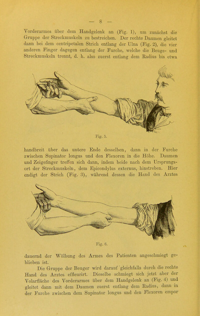 Vorderarmes über dem Handgelenk an (Fig. 1), um zmiächst die Gruppe der Streckmuskeln zu bestreichen. Der rechte Daumen gleitet dann bei dem centripetalen Strich entlang der Ulna (Fig. 2), die vier anderen Finger dagegen entlang der Furche, welche die Beuge- und Streckmuskeln trennt, d. h. also zuerst entlang dem Radius bis etwa Fig. 5. handbreit über das untere Ende desselben, dann in der Furche zwischen Supinator longus und den Flexoren in die Höhe. Daumen und Zeigefinger treffen sich dann, indem beide nach dem TJrsprungs- ort der Streckmuskeln, dem Epicondylus externus, hinstreben. Hier endigt der Strich (Fig. 3), während dessen die Hand des Arztes Fig. 6. dauernd der Wölbung des Armes des Patienten angeschmiegt ge- blieben ist. Die Gruppe der Beuger wird darauf 'gleichfalls durch die rechte Hand des Arztes effleurirt. Dieselbe schmiegt sich jetzt aber der Volarfläche des Vorderarmes über dem Handgelenk an (Fig. 4) und gleitet dann mit dem Daumen zuerst entlang dem Radius, dann in der Furche zwischen dem Supinator longus und den Flexoren empor