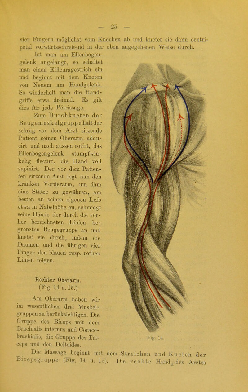 vier Fingern möglichst vom Knochen ab und knetet sie dann centri- petal vorwärtsschreitend in der oben angegebenen Weise durch. Ist man am Ellenbogen- gelenk angelangt, so schaltet man einen Eflleuragestrich ein und beginnt mit dem Kneten von Neuem am Handgelenk. So wiederholt man die Hand- griffe etwa di'eimal. Es gilt dies für jede Petrissage. Zum Durchkneten der Beugemuskelgruppe hält der schräg vor dem Arzt sitzende Piitient seinen Oberarm addu- cirt und nach aussen rotirt, das Ellenbogengelenk stumpfwin- kelig flectirt, die Hand voll supinirt. Der vor dem Patien- ten sitzende Arzt legt nun den kranken Vorderarm, um ihm eine Stütze zu gewähren, am besten an seinen eigenen Leib etwa in Nabelhöhe an, schmiegt seine Hände der durch die vor- her bezeichneten Linien be- grenzten Beugegruppe an und knetet sie durch, indem die Daumen und die übrigen vier Einger den blauen resp. rothen Linien folgen. Rechter Oberarm. (Fig. 14 u. 15.) Am Oberarm haben wir im wesenthchen drei Muskel- gruppen zu berücksichtigen. Die Gruppe des Biceps mit dem Brachiahs internus und Coraco- ceps und den Deltoides. Die Massage beginnt mit dem Streichen und Kneten der Bicepsgruppe (Fig. 14 u. 1.0). Die rechte Hand^ des Arztes