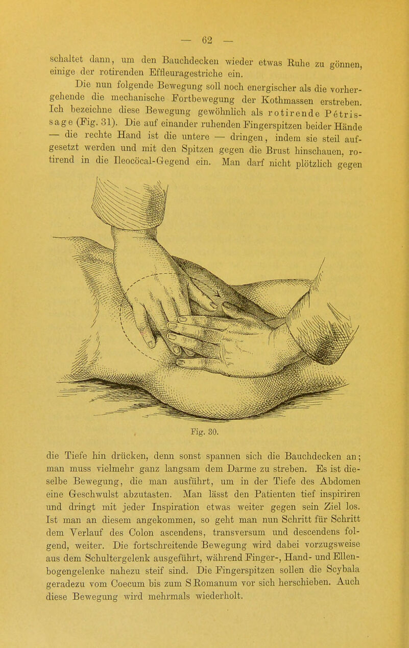 schaltet dann, um den Bauchdeckeu wieder etwas Euhe zu gönnen, einige der rotirenden Effleuragestriche ein. ' Die nun folgende Bewegung soll noch energischer als die vorher- gehende die mechanische Portbewegung der Kothmassen erstreben. Ich bezeichne diese Bewegung gewöhnUch als rotirende Petris- sage (Fig. 31). Die auf einander ruhenden Fingerspitzen beider Hände — die rechte Hand ist die imtere — dringen, indem sie steil auf- gesetzt werden und mit den Spitzen gegen die Brust hinschauen, ro- tirend in die Ileocöcal-Gegend ein. Man darf nicht plötzUch gegen Fig. 30. die Tiefe hin drücken, denn sonst spannen sich die Bauchdecken an; man muss vielmehr ganz langsam dem Darme zu streben. Es ist die- selbe Bewegung, che man ausführt, um in der Tiefe des Abdomen eine Geschwulst abzutasten. Man lässt den Patienten tief inspiriren und dringt mit jeder Inspiration etwas weiter gegen sein Ziel los. Ist man an diesem angekommen, so geht man nun Schritt für Schritt dem Verlauf des Colon ascendens, transversum imd descendens fol- gend, weiter. Die fortschreitende Bewegung wird dabei vorzugsweise aus dem Schultergelenk ausgeführt, während Finger-, Hand- und Ellen- bogengelenke nahezu steif sind. Die Fingerspitzen sollen die Scybala geradezu vom Coecum bis zum S Komanum vor sich herschieben. Auch diese Bewegung wird mehrmals wiederholt.