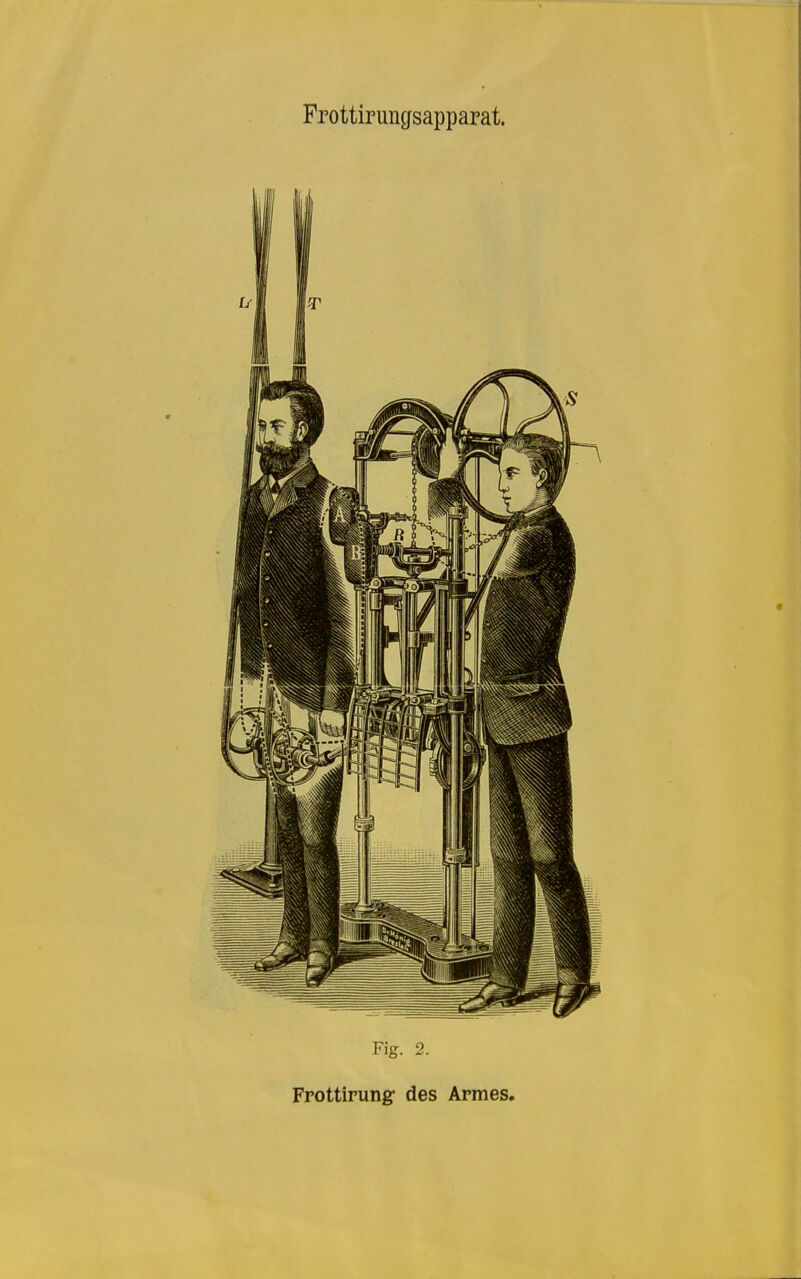 Fig. 2. Frottirung- des Armes,