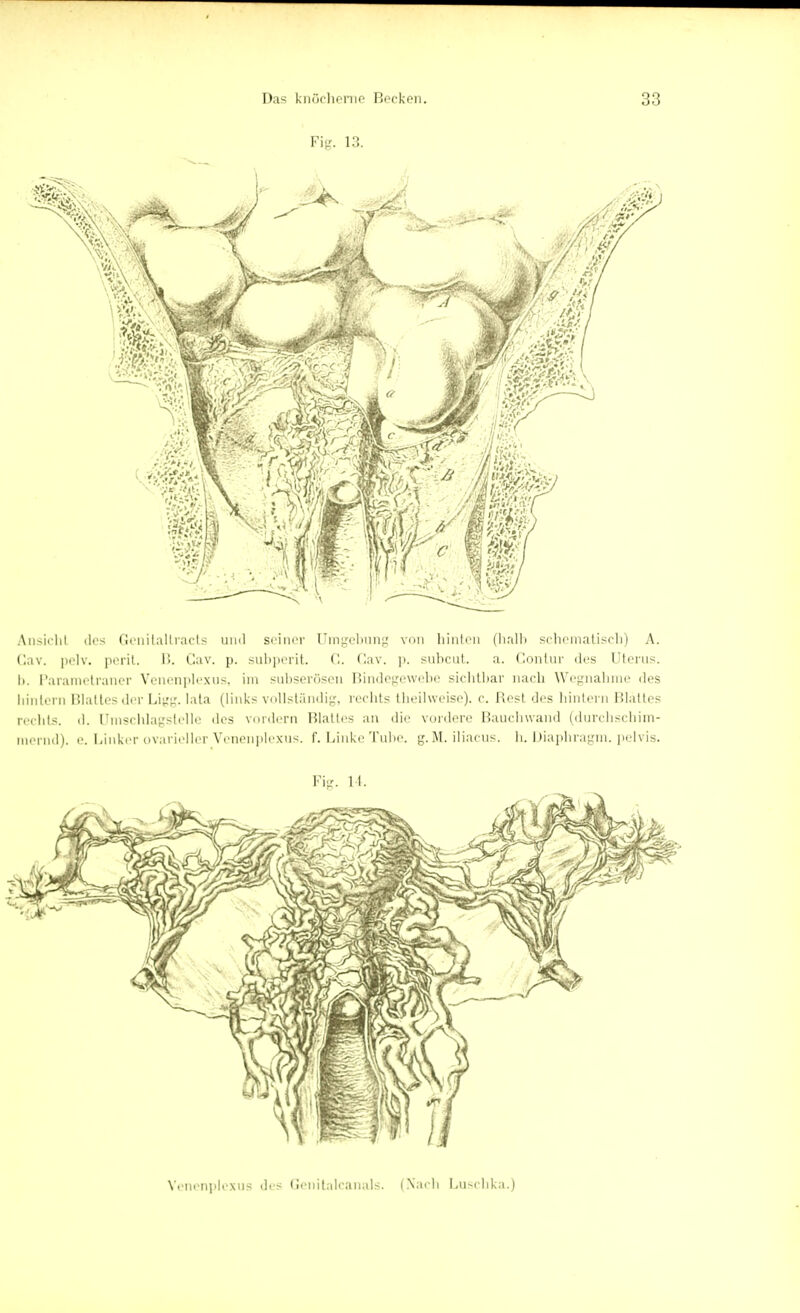 Fig. 13. Ansicht iles Genilallracts und seiner Umgebung von liinlen (halb schomatisoh) A. Cav. pelv. perit. !!. Cav. p. subperit. C. Cav. p. subcut a. Contur iles Uterus. I). Parametraner Venenplexus, im subserösen Bindegewebe sichtbar nach Wegnahme des hintern Blattes der Ligg. lata (links vollständig, rechts theilweise). c. Rest des hintern Blattes rechts, d. Umschlagstelle des vordem Blattes an die vordere Bauchwand (durchschim- mernd), e. Linker ovarieller Venenplexus. f. Linke Tube. g.M. iliacus. h. Diaphragm. pelvis. Fig. 14. Venenplexus des Genitalcanals. (Nach Luschka.)