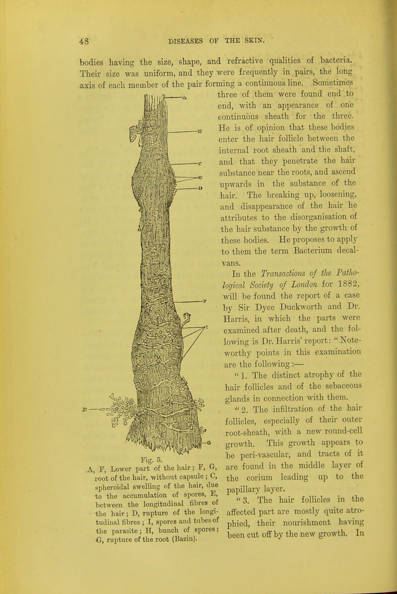 bodies having the size, shape, and refractive qualities of bacteria. Their size was uniform, and they were frequently in pairs, the long axis of each member of the pair forming a continuous line. Sometimes three of them were found end to end, with an appearance of one continuous sheath for the three. He is of opinion that these bodies enter the hair follicle between the internal root sheath and the shaft, and that they penetrate the hair substance near the roots, and ascend upwards in the substance of the hair. The breaking up, loosening, and disappearance of the hair he attributes to the disorganisation of the hair substance by the growth of these bodies. He proposes to apply to them the term Bacterium decal- vans. In the Transactions of the Patho- logical Society of London for 1882, will be found the report of a case by Sir Dyce Duckworth and Dr. Harris, in which the parts were examined after death, and the fol- lowing is Dr. Harris' report: Note- worthy points in this examination are the following :—  1. The distinct atrophy of the hair follicles and of the sebaceous glands in connection with them.  2. The infiltration of the hair follicles, especially of their outer root-sheath, with a new round-cell growth. This growth appears to be peri-vascular, and tracts of it are found in the middle layer of the corium leading up to the papillary layer.  3. The hair follicles in the affected part are mostly quite atro- phied, their nourishment having been cut off by the new growth. In Fig. 5. A, F, Lower part of the hair; F, G, root of the hair, without capsule ; C, spheroidal swelling of the hair, clue to the accumulation of spores, E, between the longitudinal fibres of the hair; D, rupture of the longi- tudinal fibres ; I, spores and tubes of the parasite; H, bunch of spores; G, rupture of the root (Baziu).