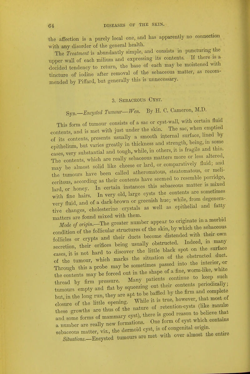the affection is a purely local one, and has apparently no connection with any disorder of the general health. The Treatment is abundantly simple, and consists in puncturing the upper wall of each milium and expressing its contents. If there is a decided tendency to return, the base of each may be moistened with tincture of iodine after removal of the sebaceous matter, as recom- mended by Piffard, but generally this is unnecessary. 3. Sebaceous Cyst. $yn.—Encysted Tumour—Wen. By H. C. Cameron, M.D. This form of tumour consists of a sac or cyst-wall, with certain fluid contents, and is met with just under the skin The sac, when emptied of its contents, presents usually a smooth internal surface, lined by epithelium, but varies greatly in thickness and strength being, in some cases, very substantial and tough, while, in others, it is fragile and thin. The contents, which are really sebaceous matters more or less altered mav be almost solid like cheese or lard, or comparatively fluid; and the tumours have been called atheromatous, steatomatous or meh- ceritous, according as their contents have seemed to resemble pon^ lard or honey. In certain instances this sebaceous matter is mixed IS fine hairs. In very old, large cysts the contents are sometimes Zy fluid, and of a dark-brown or greenish hue; winle from da- tive changes, cholesterine crystals as well as epithelial and fattj matters are found mixed with them. _ Mode of —.-The greater number appear to originate m a moibid conSnonhe f ollicukfr structures of the skin, by which the sebaceous olMes or crypts and their ducts become distended with their own 11itZn their orifices being usually obstructed. Indeed in many a e Tis not hard to discover the little black spot on the surface o the tumour, which marks the situation of the Through this a probe maybe sometimes passed mto the interior or Sent may\e forced out in the shape of thread by firm pressure. Many patients continue to **P*V* tumours empty and flat by squeezing out their contents penodically, tumours empvy *u j i md complete but, in the long run, they are, .pb *te*fl*7 ^ ^ rf closure of the little opening. While it is, ^ these growths are thus of th^ natureol J V ^ and some forms of mammary ^'^^ of cyst which contains a number are really new formations. Une 101m ui y sebaceous matter, vi,, the dermoid cyst, is off <jongenit W0«S.-Encysted tumours are met with over almost the entue