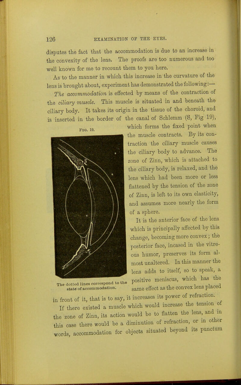 Fig. 19. disputes the fact that the accommodation is due to an increase in the convexity of the lens. The proofs are too numerous and too well known for me to recount them to you here. As to the manner in which this increase in the curvature of the lens is brought about, experiment has demonstrated the following:— The accommodation is effected by means of the contraction of the ciliary muscle. This muscle is situated in and beneath the ciliary body. It takes its origin in the tissue of the choroid, and is inserted in the border of the canal of Schlemm (S, Fig 19), which forms the fixed point when the muscle contracts. By its con- traction the ciliary muscle causes the ciliary body to advance. The zone of Zinn, which is attached to the ciliary body, is relaxed, and the lens which had been more or less flattened by the tension of the zone of Zinn, is left to its own elasticity, and assumes more nearly the form of a sphere. It is the anterior face of the lens which is principally affected by this change, becoming more convex; the posterior face, incased in the vitre- ous humor, preserves its form al- most unaltered. In this manner the lens adds to itself, so to speak, a positive meniscus, which has the same effect as the convex lens placed front of it, that is to say, it increases its power of refraction. If there existed a muscle which would increase the tension of the zone of Zinn, its action would be to flatten the lens, and in this case there would be a diminution of refraction, or m other words, accommodation for objects situated beyond its punctum The dotted lines correspond to the state of accommodation. in