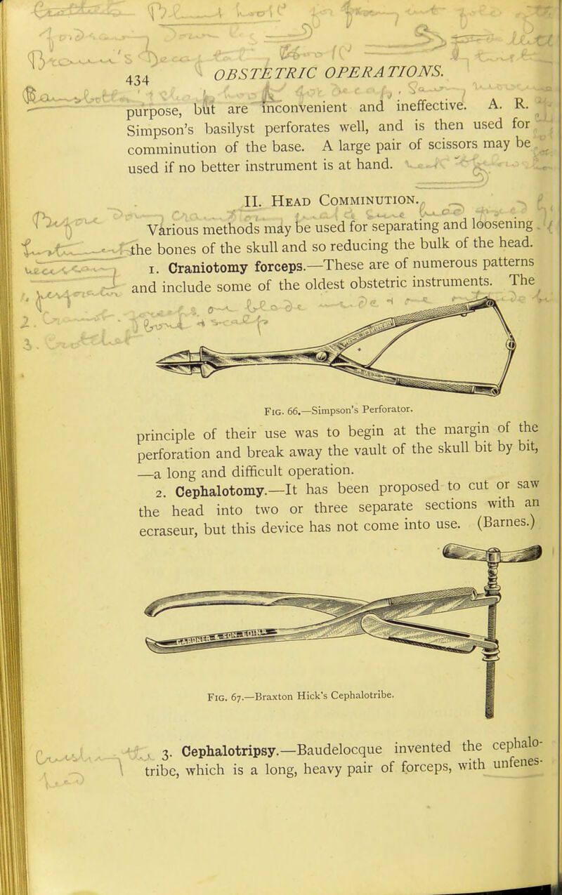 purpose, but are inconvenient and ineffective. A. K. Simpson's basilyst perforates well, and is then used for comminution of the base. A large pair of scissors may be used if no better instrument is at hand. Head Comminution. II. Various methods may be used for separating and loosening . -^he bones of the skull and so reducing the bulk of the head, i. Craniotomy forceps.—These are of numerous patterns the oldest obstetric instruments. The and include some of the oldest obstetric instruments Fig. 66.—Simpson's Perforator. principle of their use was to begin at the margin of the perforation and break away the vault of the skull bit by bit, —a long and difficult operation. 2 Omphalotomy.—It has been proposed to cut or saw the head into two or three separate sections with an ecraseur, but this device has not come into use. (Barnes.) Fig. 67—Braxton Hick's Cephalotribe. 3. Cephalotripsy.—Baudelocque invented the cephalo- tribe, which is a long, heavy pair of forceps, with unfenes-