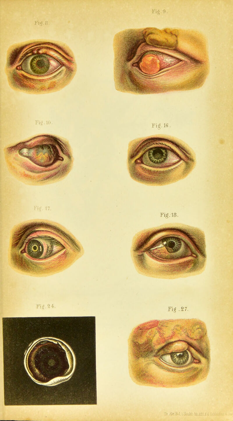 Pig.9. IV Akt.ft.1 ioiocWUU
