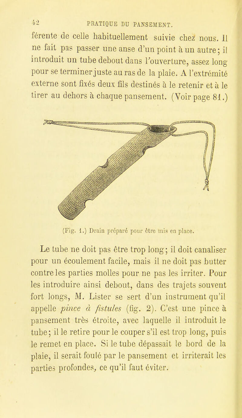 férente de celle habituellement suivie chez nous. 11 ne fait pas passer une anse d'un point à un autre; il introduit un tube debout dans l'ouverture, assez long pour se terminer juste au ras de la plaie. A l'extrémité externe sont fixés deux fils destinés à le retenir et à le tirer au dehors à chaque pansement. (Voir page 81.) (Fig. i.) Drain préparé pour être mis en place. Le tube ne doit pas être trop long; il doit canaliser pour un écoulement facile, mais il ne doit pas butter contre les parties molles pour ne pas les irriter. Pour les introduire ainsi debout, dans des trajets souvent fort longs, M. Lister se sert d'un instrument qu'il appelle pince à fistules (fig. 2). C'est une pince à pansement très étroite, avec laquelle il introduit le tube; il le retire pour le couper s'il est trop long, puis le remet en place. Si le tube dépassait le bord de la plaie, il serait foulé par le pansement et irriterait les parties profondes, ce qu'il faut éviter.