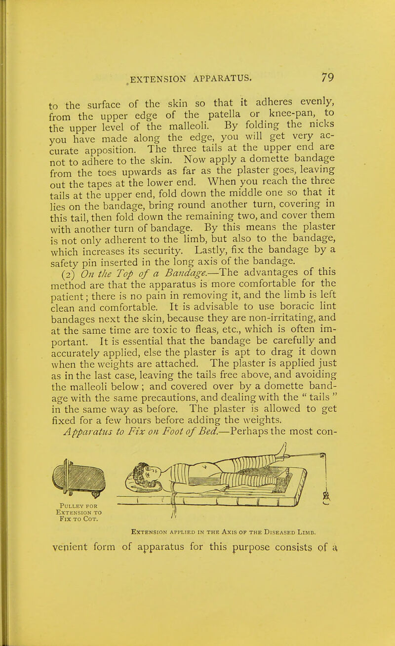 to the surface of the skin so that it adheres evenly, from the upper edge of the patella or knee-pan, to the upper level of the malleoli. By folding the nicks you have made along the edge, you will get very ac- curate apposition. The three tails at the upper end are not to adhere to the skin. Now apply a domette bandage from the toes upwards as far as the plaster goes, leaving out the tapes at the lower end. When you reach the three tails at the upper end, fold down the middle one so that it lies on the bandage, bring round another turn, covering in this tail, then fold down the remaining two, and cover them with another turn of bandage. By this means the plaster is not only adherent to the limb, but also to the bandage, which increases its security. Lastly, fix the bandage by a safety pin inserted in the long axis of the bandage. (2) On the Top of a Bandage.—The advantages of this method are that the apparatus is more comfortable for the patient; there is no pain in removing it, and the limb is left clean and comfortable. It is advisable to use boracic lint bandages next the skin, because they are non-irritating, and at the same time are toxic to fleas, etc., which is often im- portant. It is essential that the bandage be carefully and accurately applied, else the plaster is apt to drag it down when the weights are attached. The plaster is applied just as in the last case, leaving the tails free above, and avoiding the malleoli below ; and covered over by a domette band- age with the same precautions, and dealing with the  tails  in the same way as before. The plaster is allowed to get fixed for a few hours before adding the weights. Apparatus to Fix on Foot of Bed.—Perhaps the most con- pulley for Extension to Fix to Cot. Extension applied in the Axis of the Diseased Limb. venient form of apparatus for this purpose consists pf a