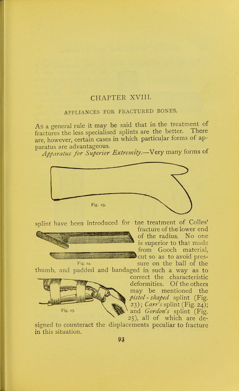 APPLIANCES FOR FRACTURED BONES. As a general rule it may be said that in the treatment of fractures the less specialised splints are the better. There are, however, certain cases in which particular forms of ap- paratus are advantageous. Apparatus for Superior Extremity.—Y&xy many forms of Fig. 23, splint have been introduced for tne treatment of Colles' fracture of the lower end of the radius. No one is superior to that made from Gooch material, cut so as to avoid pres- Fig- 24. sure on the ball of the thumb, and padded and bandaged in such a way as to correct the characteristic deformities. Of the others may be mentioned the pistol - shaped splint (Fig. 23); Carr's splint (Fig. 24); F'g- V Wk^ and Gordon's splint (Fig. 25), all of which are de- signed to counteract the displacements peculiar to fracture in this situation.