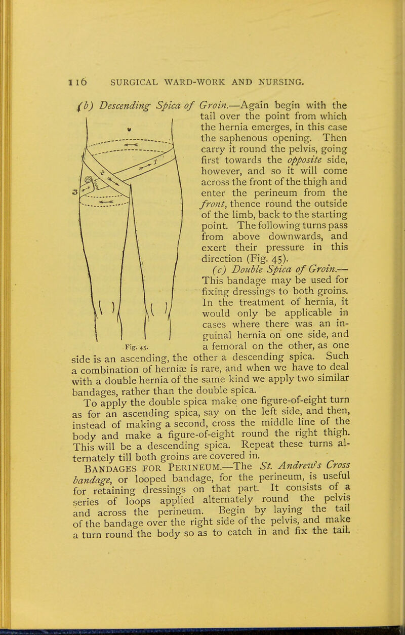 (b) Descending Spica of Groin.—Again begin with the tail over the point from which the hernia emerges, in this case the saphenous opening. Then carry it round the pelvis, going first towards the opposite side, however, and so it will come across the front of the thigh and enter the perineum from the front, thence round the outside of the limb, back to the starting point. The following turns pass from above downwards, and exert their pressure in this direction (Fig. 45). (c) Double Spica of Groin.— This bandage may be used for fixing dressings to both groins. In the treatment of hernia, it would only be applicable in cases where there was an in- guinal hernia on one side, and a femoral on the other, as one side is an ascending, the other a descending spica. Such a combination of hernia; is rare, and when we have to deal with a double hernia of the same kind we apply two similar bandages, rather than the double spica. To apply the double spica make one figure-of-eight turn as for an ascending spica, say on the left side, and then, instead of making a second, cross the middle line of the body and make a figure-of-eight round the right thigh. This will be a descending spica. Repeat these turns al- ternately till both groins are covered in. Bandages for Perineum.—The St. Andrews Cross bandage, or looped bandage, for the perineum, is useful for retaining dressings on that part. It consists of a .series of loops applied alternately round the pelvis and across the perineum. Begin by laying the tail of the bandage over the right side of the pelvis, and make a turn round the body so as to catch in and fix the tail. Fig. 45-