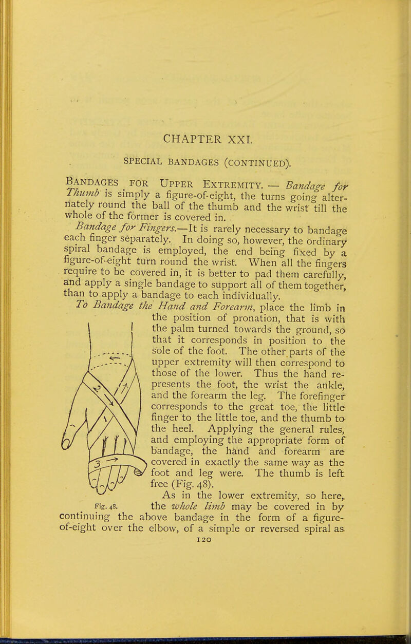 SPECIAL BANDAGES (CONTINUED). Bandages for Upper Extremity. — Bandage for Ihumb IS simply a figure-of-eight, the turns going alter- nately round the ball of the thumb and the wrist till the whole of the former is covered in. Bandage for Fingers.—It is rarely necessary to bandage each finger separately, In doing so, however, the ordinary spiral bandage is employed, the end being fixed by a figure-of- eight turn round the wrist. When all the fingers require to be covered in, it is better to pad them carefully, and apply a single bandage to support all of them together, than to apply a bandage to each individually. T0 Bandage the Hand and Forearm, place the limb in the position of pronation, that is with the palm turned towards the ground, so that it corresponds in position to the sole of the foot. The other parts of the upper extremity will then correspond to those of the lower. Thus the hand re- presents the foot, the wrist the ankle, and the forearm the leg. The forefinger corresponds to the great toe, the little finger to the little toe, and the thumb tO' the heel. Applying the general rules, and employing the appropriate form of bandage, the hand and forearm are covered in exactly the same way as the foot and leg were. The thumb is left free (Fig. 48). As in the lower extremity, so here,. Fig. 48. the tvhole limb may be covered in by continuing the above bandage in the form of a figure- of-eight over the elbow, of a simple or reversed spiral as.