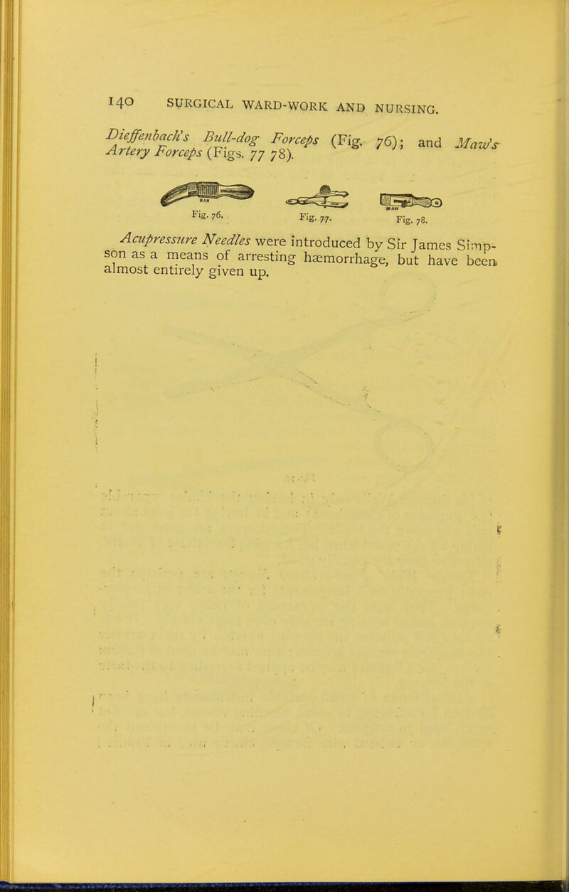 DieffenbacJCs BzUl-dog Forceps (Fig. 76); and Ma'o/s- Ariery Forceps {Vigs. 77 y^). Fig. 76. Fig. 77. Fig. 78. Aaipressure Needles were introduced by Sir Tames Simp- son as a means of arresting haemorrhage, but have bcea almost entn-ely given up.