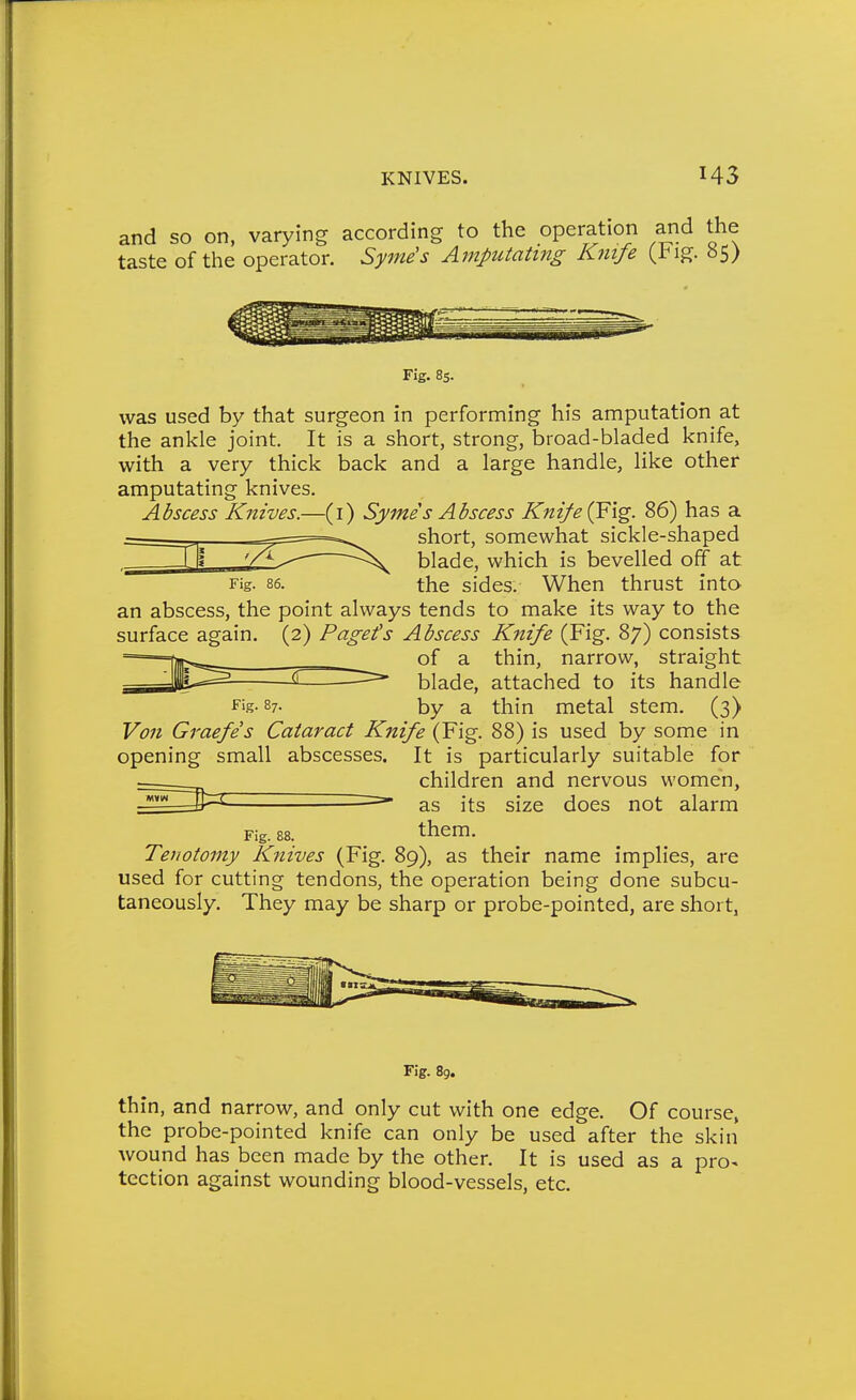 KNIVES. and so on, varying according to the operation and the taste of the operator. Syme's Amputating Knife (i^ig. b5> Fig. 85. was used by that surgeon in performing his amputation at the ankle joint. It is a short, strong, broad-bladed knife, with a very thick back and a large handle, like other amputating knives. Abscess Knives.—(i) Symes Abscess Knife 86) has a short, somewhat sickle-shaped ''^ ^ blade, which is bevelled off at Fig. 86. the sides. When thrust into an abscess, the point always tends to make its way to the surface again. (2) Pagets Abscess Knife (Fig. 87) consists of a thin, narrow, straight —blade, attached to its handle Fig- 87- by a thin metal stem. (3) Von Graefes Cataract Knife (Fig. 88) is used by some in opening small abscesses. It is particularly suitable for children and nervous women, size does not alarm Fig. 88. as its them. Tenotomy Knives (Fig. 89), as their name implies, are used for cutting tendons, the operation being done subcu- taneously. They may be sharp or probe-pointed, are short, Fig. 8g. thin, and narrow, and only cut with one edge. Of course, the probe-pointed knife can only be used after the skin wound has been made by the other. It is used as a pro^ tection against wounding blood-vessels, etc.