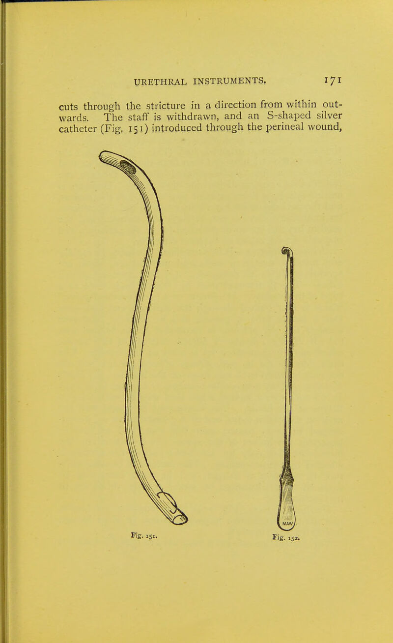 cuts through the stricture in a direction from within out- wards. The staff is withdrawn, and an S-shaped silver catheter (Fig, 151) introduced through the perineal wound, ^'S- 151. Fig. 152.