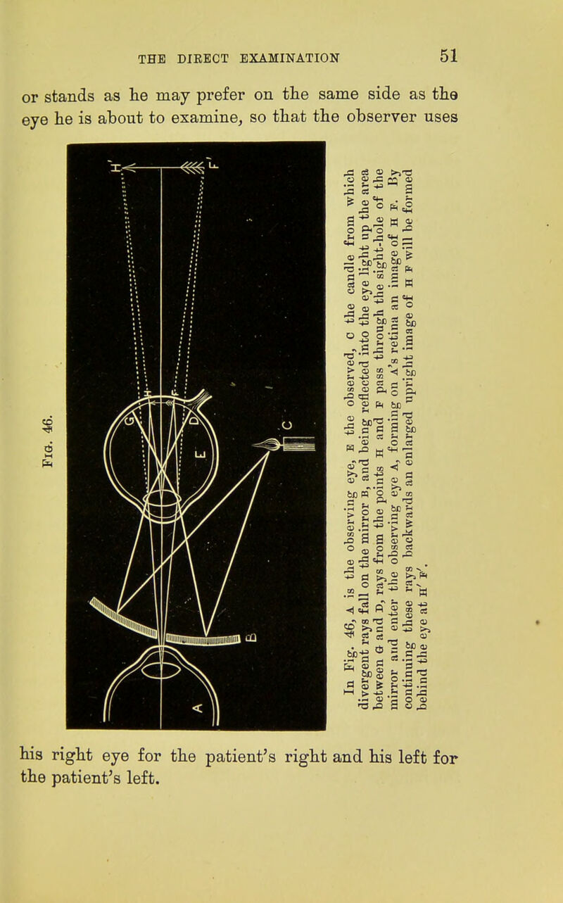 or stands as lie may prefer on the same side as the eye he is about to examine, so that the observer uses CD g' o CM 3 u ^ S ^ ^ 2 W a b 6d > « to QJ o <0 J3 bo's 6X3 B .s *o o aj S -a 0 oi D CD be 1 ^ o g a s « 0) u O cn oi be <I> IS rS ,£3 11^ C <U ^ bcaj o .13 c g his right eye for the patient's right and his left for the patient's left.