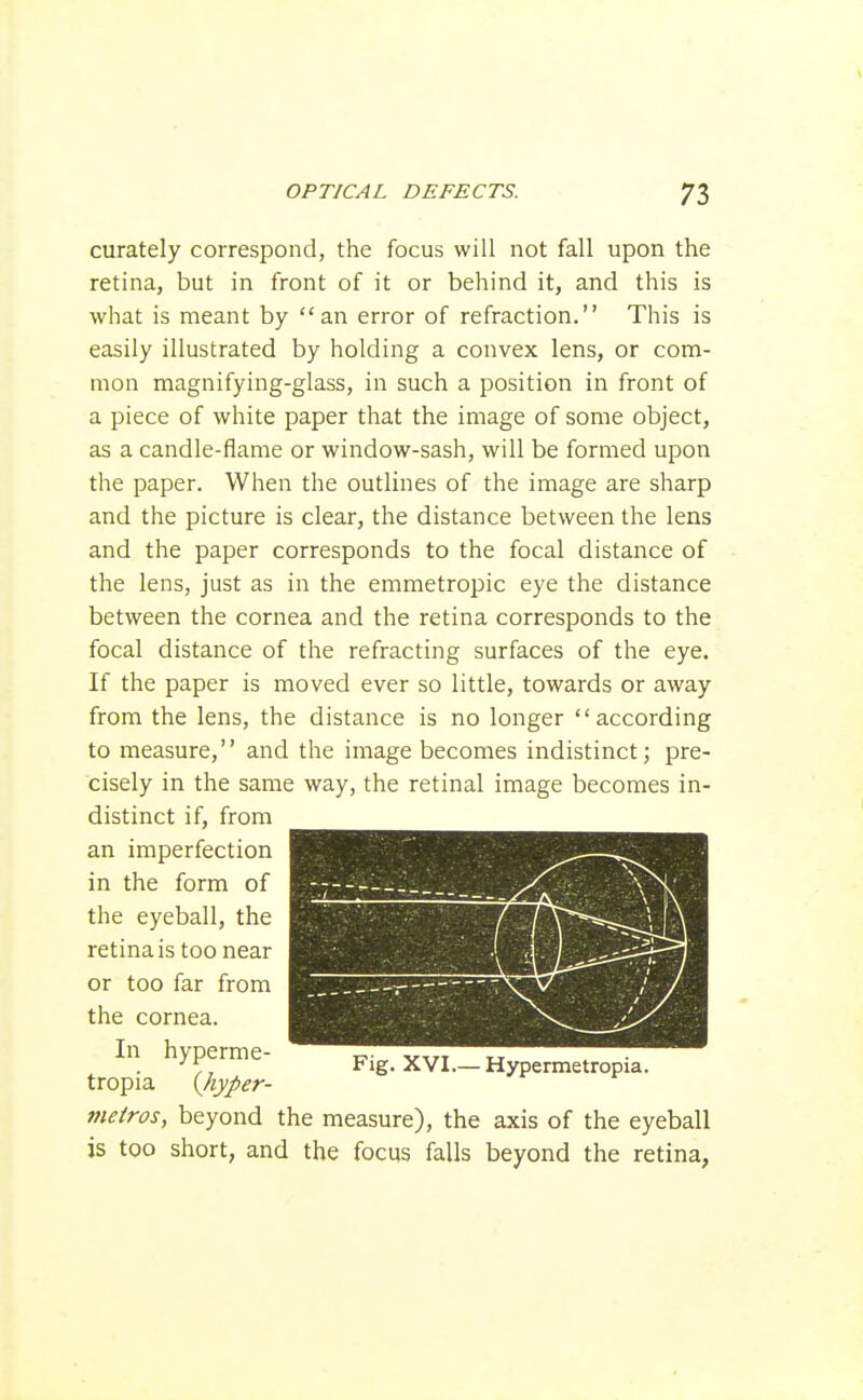 curately correspond, the focus will not fall upon the retina, but in front of it or behind it, and this is what is meant by an error of refraction. This is easily illustrated by holding a convex lens, or com- mon magnifying-glass, in such a position in front of a piece of white paper that the image of some object, as a candle-flame or window-sash, will be formed upon the paper. When the outlines of the image are sharp and the picture is clear, the distance between the lens and the paper corresponds to the focal distance of the lens, just as in the emmetropic eye the distance between the cornea and the retina corresponds to the focal distance of the refracting surfaces of the eye. If the paper is moved ever so little, towards or away from the lens, the distance is no longer according to measure, and the image becomes indistinct; pre- cisely in the same way, the retinal image becomes in- distinct if, from an imperfection in the form of the eyeball, the retina is too near or too far from the cornea. In hyperme- tropia {hyper- meiros, beyond the measure), the axis of the eyeball is too short, and the focus falls beyond the retina, Fig. XVI.— Hypermetropia.