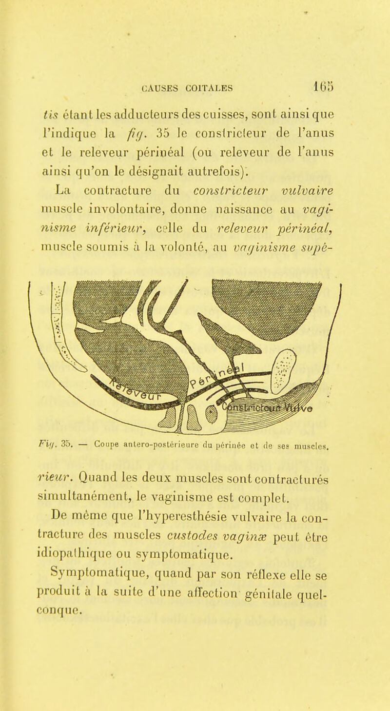 tis étant lcsacklucleursd.es cuisses, sont ainsi que l'indique la fig. 35 le conslricleur de l'anus et le releveur périnéal (ou releveur de l'anus ainsi qu'on le désignait autrefois). La contracture du constricteur vulvaire muscle involontaire, donne naissance au vagi- nisme inférieur, celle du releveur périnéal, muscle soumis à la volonté, au vaginisme supè- Fii/. 35. — Coupe antero-poslérieure du périnée et de ses muscles. rieur. Quand les deux muscles sont contraeturés simultanément, le vaginisme est complet. De même que l'hyperesthésie vulvaire la con- tracture des muscles custodes vaginse peut être idiopathique ou symptomatique. Symptornatique, quand par son réflexe elle se produit à la suite d'une affection génitale quel- conque.