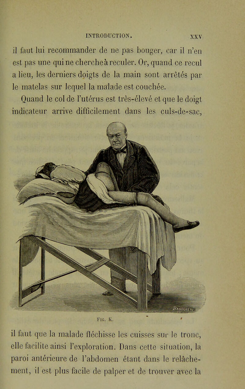 il fout lui recommander de ne pas bouger, car il n'en est pas une qui ne cherche à reculer. Or, quand ce recul a lieu, les derniers doigts de la main sont arrêtés par le matelas sur lequel la malade est couchée. Quand le col de l'utérus est très-élevé et que le doigt indicateur arrive difficilement dans les culs-de-sac, Fie. K. il faut que la malade fléchisse les cuisses sur le tronc, elle facilite ainsi l'exploration. Dans cette situation, la paroi antérieure de l'abdomen étant dans le relâche- ment, il est plus facile de palper et de trouver avec la