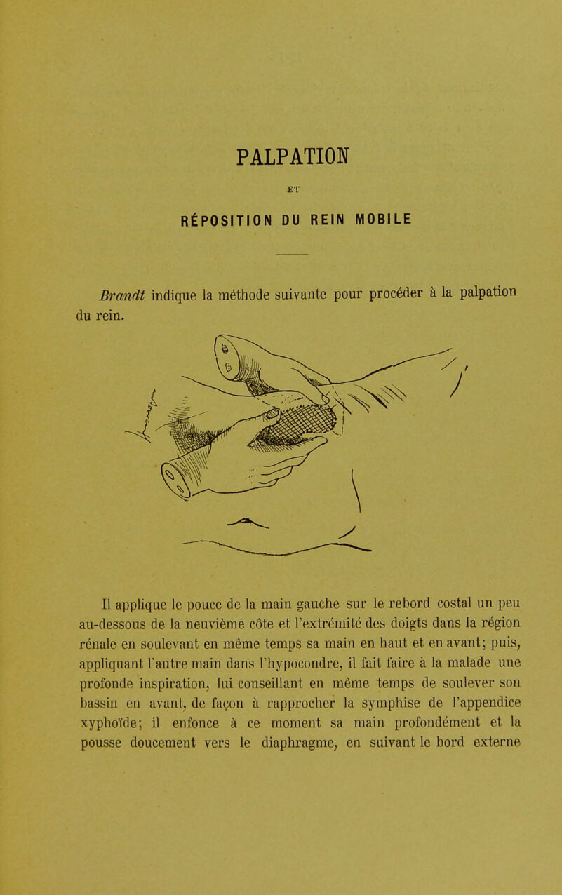 ET RÉPOSITION DU REIN MOBILE Brandt indique la méthode suivante pour procéder à la palpation du rein. Il applique le pouce de la main gauche sur le rebord costal un peu au-dessous de la neuvième côte et l'extrémité des doigts dans la région rénale en soulevant en même temps sa main en haut et en avant; puis, appliquant l'autre main dans Thypocondre, il fait faire à la malade une profonde inspiration; lui conseillant en même temps de soulever son bassin en avant, de façon à rapprocher la symphise de l'appendice xyphoïde; il enfonce à ce moment sa main profondément et la pousse doucement vers le diaphragme, en suivant le bord externe