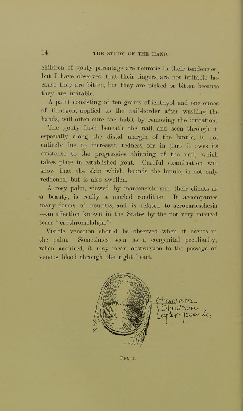 children of gouty parentage are neurotic in their tendencies • but I have observed that their fingers are not irritable be- cause they are bitten, but they are picked or bitten because they are irritable. A paint consisting of ten grains of ichthyol and one ounce of filmogen, applied to the nail-border after washing the hands, will often cure the habit by removing the irritation. The gouty flush beneath the nail, and seen through it, especially along the distal margin of the lunule, is not entirely due to increased redness, for in part it owes its existence to the progressive thinning of the nail, which takes place in established gout. Careful examination will show that the skin which bounds the lunule, is not only reddened, but is also swollen. A rosy palm, viewed by manicurists and their clients as «a beauty, is really a morbid condition. It accompanies many forms of neuritis, and is related to acroparesthesia —an affection known in the States by the not very musical term erythromelalgia.9 Visible venation should be observed when it occurs in the palm. Sometimes seen as a congenital peculiarity, when acquired, it may mean obstruction to the passage of venous blood through the right heart.