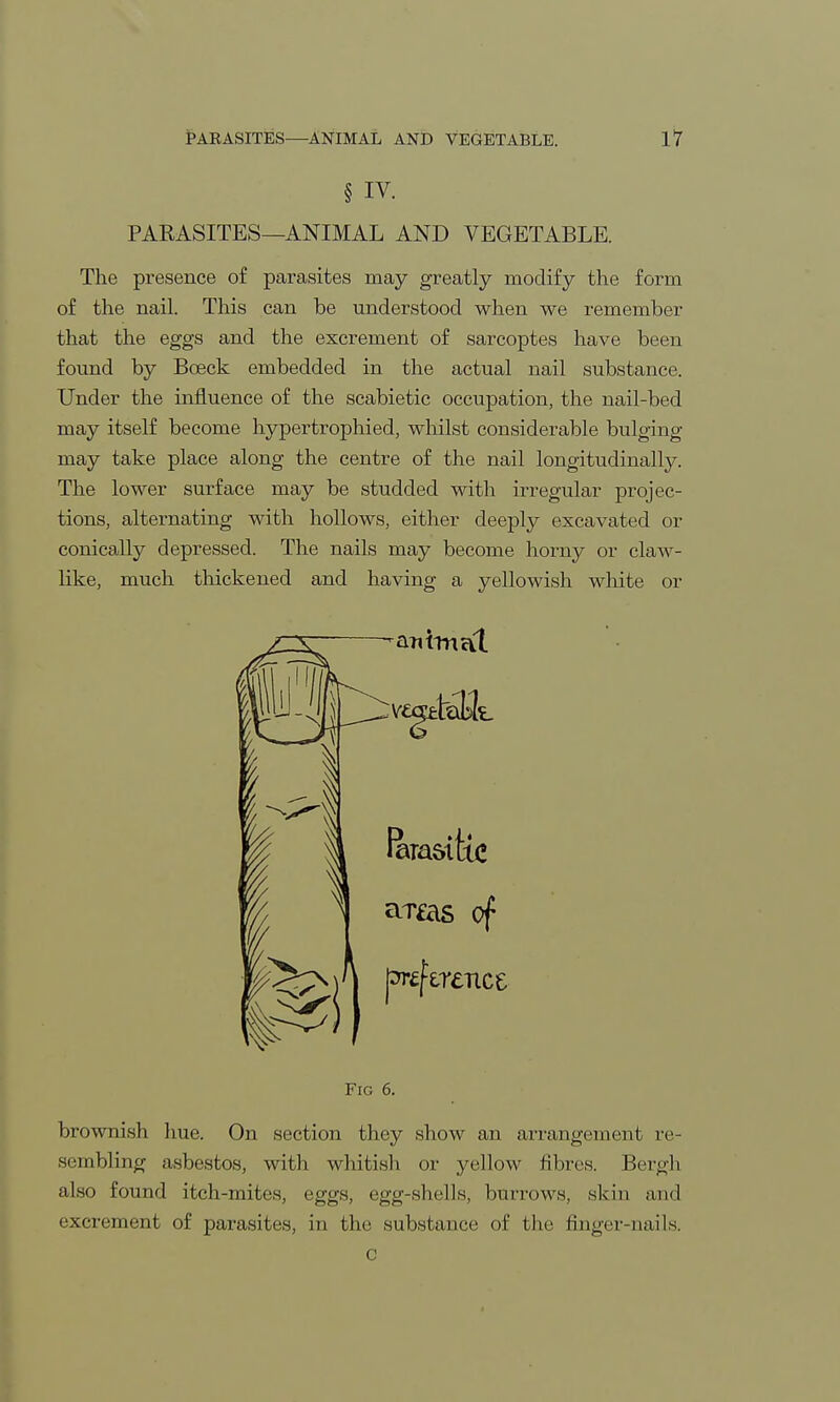 § iv. PARASITES—ANIMAL AND VEGETABLE. The presence of parasites may greatly modify the form of the nail. This can be understood when we remember that the eggs and the excrement of sarcoptes have been found by Boeck embedded in the actual nail substance. Under the influence of the scabietic occupation, the nail-bed may itself become hypertrophied, whilst considerable bulging may take place along the centre of the nail longitudinally. The lower surface may be studded with irregular projec- tions, alternating with hollows, either deeply excavated or conically depressed. The nails may become horny or claw- like, much thickened and having a yellowish white or 1 1 a.T£as of preference Fig 6. brownish hue. On section they show an arrangement re- sembling asbestos, with whitish or yellow fibres. Bergh also found itch-mites, eggs, egg-shells, burrows, skin and excrement of parasites, in the substance of the finger-nails. c