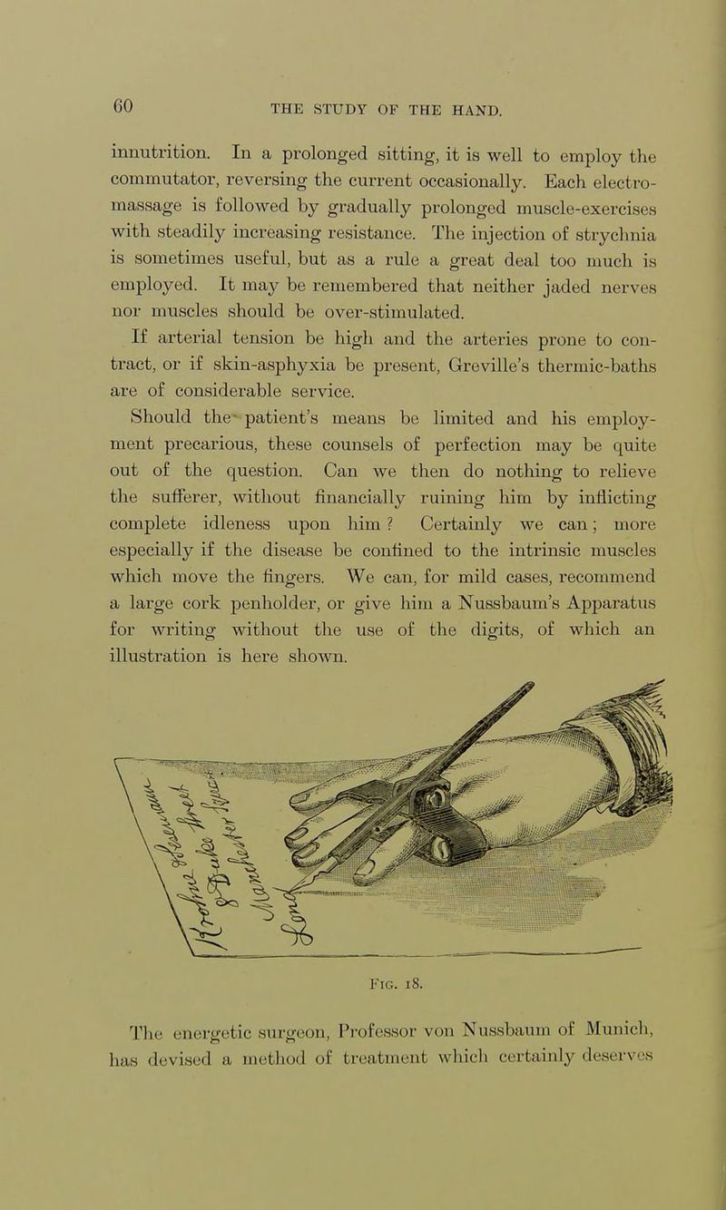 00 innutrition. In a prolonged sitting, it is well to employ the commutator, reversing the current occasionally. Each electro- massage is followed by gradually prolonged muscle-exercises with steadily increasing resistance. The injection of strychnia is sometimes useful, but as a rule a great deal too much is employed. It may be remembered that neither jaded nerves nor muscles should be over-stimulated. If arterial tension be high and the arteries prone to con- tract, or if skin-asphyxia be present, Greville's thermic-baths are of considerable service. Should the patient's means be limited and his employ- ment precarious, these counsels of perfection may be quite out of the question. Can we then do nothing to relieve the sufferer, without financially ruining him by inflicting complete idleness upon him ? Certainly we can; more especially if the disease be confined to the intrinsic muscles which move the fingers. We can, for mild cases, recommend a large cork penholder, or give him a Nussbaum's Apparatus for writing without the use of the digits, of which an illustration is here shown. Fig. i 8. The energetic .surgeon, Professor von Nussbaum of Munich, has devised a method of treatment which certainly deserves