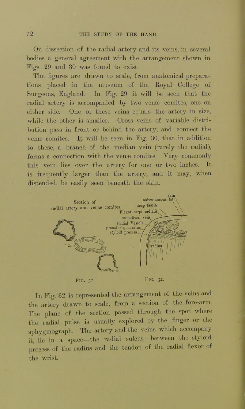 On dissection of the radial artery and its veins, in several bodies a general agreement with the arrangement shown in Figs. 29 and 30 was found to exist. The figures are drawn to scale, from anatomical prepara- tions placed in the museum of the Royal College of Surgeons, England. In Fig. 29 it will be seen that the radial artery is accompanied by two vense comites, one on either side. One of these veins equals the artery in size, while the other is smaller. Cross veins of variable distri- bution pass in front or behind the artery, and connect the venae comites. It will be seen in Fig. 30, that in addition to these, a branch of the median vein (rarely the radial), forms a connection with the venae comites. Very commonly this vein lies over the artery for one or two inches. It is frequently larger than the artery, and it may, when distended, be easily seen beneath the skin. skin o c subcutaneous fat \ Section of . radial artery and venae comites. deeP la,ola-. Flexor carpi radiahY \ superficial vein Ecdial Vessels, pronator quadratus rtyloid process. Fig. 3' Fig. 32. In Fig. 32 is represented the arrangement of the veins and the artery drawn to scale, from a section of the fore-arm. The plane of the section passed through the spot where the radial pulse is usually explored by the finger or the aphygmograph. The artery and the veins which accompany it, lie in a space—the radial sulcus—between the styloid process of the radius and the tendon of the radial flexor of the wrist.