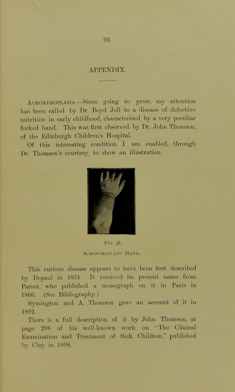 APPENDIX. Achondroplasia.—Since going to press, my attention has been called by Dr. Boyd Joll to a disease of defective nutrition in early childhood, characterised by a very peculiar forked hand. This was first observed by Dr. John Thomson, of the Edinburgh Children's Hospital. Of this interesting condition I am enabled, through Dr. Thomson's courtesy, to show an illustration. Fig. 38. achondroplasic hand. This curious disease appears to have been first described by Depaul in 1851. It received its present name from Parrot, who published a monograph on it in Paris in 1866. (See Bibliography.) Symington and A. Thomson gave an account of it in 1892. There is a full description of it by John Thomson, at page 298 of his well-known work on  The Clinical Examination and Treatment of Sick Children, published by Clay in 1898.