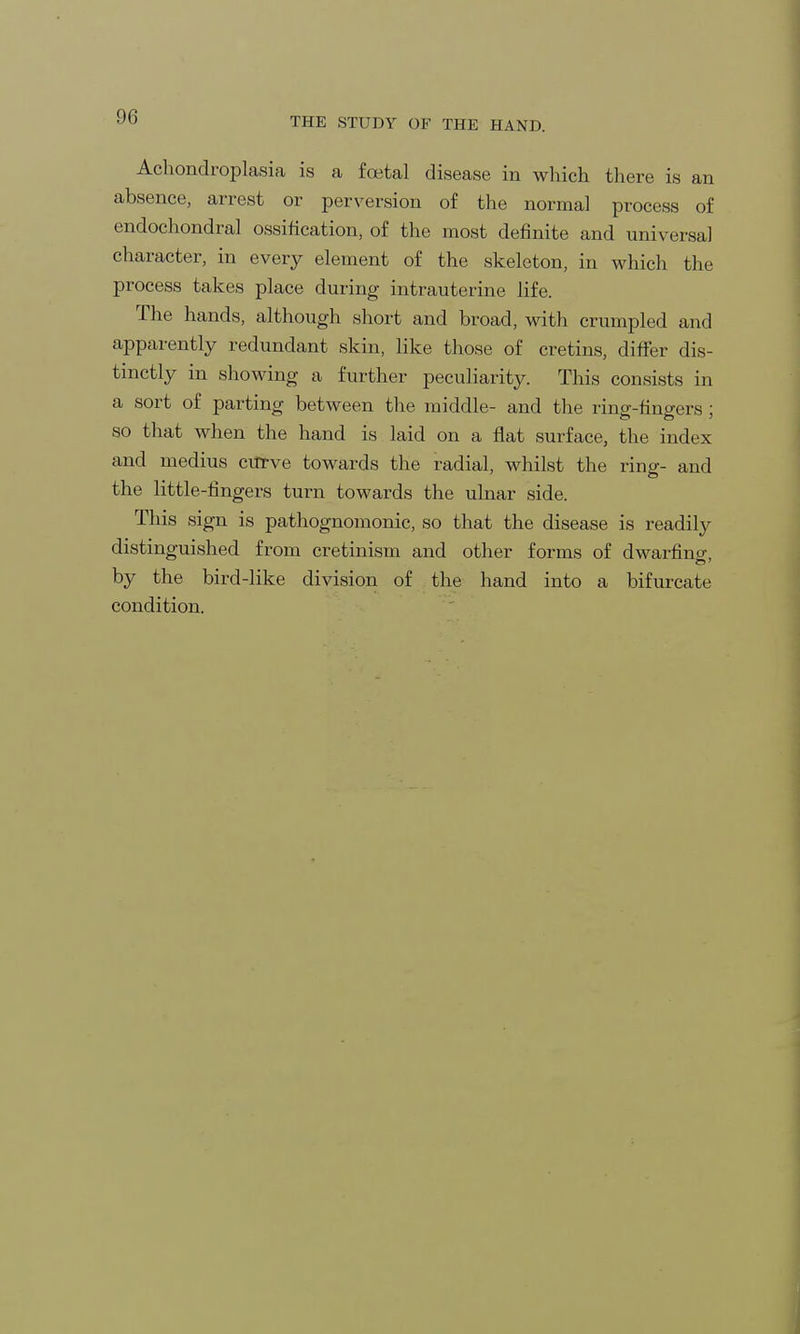 Achondroplasia is a foetal disease in which there is an absence, arrest or perversion of the normal process of endochondral ossification, of the most definite and universal character, in every element of the skeleton, in which the process takes place during intrauterine life. The hands, although short and broad, with crumpled and apparently redundant skin, like those of cretins, differ dis- tinctly in showing a further peculiarity. This consists in a sort of parting between the middle- and the ring-fingers ; so that when the hand is laid on a flat surface, the index and medius curve towards the radial, whilst the ring- and the little-fingers turn towards the ulnar side. This sign is pathognomonic, so that the disease is readily distinguished from cretinism and other forms of dwarfing by the bird-like division of the hand into a bifurcate condition.