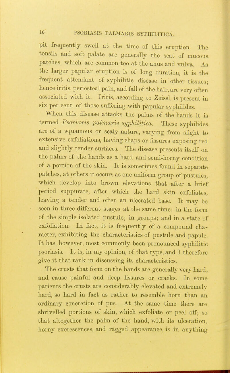pit frequently swell at the time of this eruption. The tonsils and soft palate are generally the seat of mucous patches, which are common too at the anus and vulva. As the larger papular eruption is of long duration, it is the frequent attendant of syphilitic disease in other tissues; hence iritis, periosteal pain, and fall of the hair, are very often associated with it. Iritis, according to Zeissl, is present in six per cent, of those suffering with papular syphilides. When this disease attacks the palms of the hands it is termed Psoriaris jpalmaris syphilitica. These syphilides are of a squamous or scaly nature, varying from shght to extensive exfoliations, having chaps or fissures exposing red and slightly tender surfaces. The disease presents itself on the palms of the hands as a hard and semi-horny condition of a portion of the skin. It is sometimes found in separate patches, at others it occurs as one uniform group of pustules, which develop into brown elevations that after a brief period suppurate, after which the hard skin exfoliates, leaving a tender and often an ulcerated base. It may be seen in three different stages at the same time: in the form of the simple isolated pustule; in groups; and in a state of exfoliation. In fact, it is frequently of a compound cha- racter, exhibiting the characteristics of pustule and papule. It has, however, most commonly been pronounced syphilitic psoriasis. It is, in my opinion, of that type, and I therefore give it that rank in discussing its characteristics. The crusts that form on the hands are genei-aUy very hard, and cause painful and deep fissures or cracks. In some patients the crusts are considerably elevated and extremely hard, so hard in fact as rather to resemble horn than an ordinary concretion of pus. At the same time there are shrivelled portions of skin, which exfoliate or peel off*; so that altogether the palm of the hand, with its ulceration, horny excrescences, and ragged appearance, is in anything