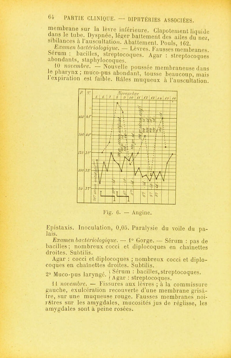 membrane sur la lèvre inférieure. Clapotement liquide dans le tube Dyspnée, léger battement des ailes du ne/ sibilances a 1 auscultation. Abattement. Pouls 162 Examen haciériologique. — Lèvres. Fausses membranes, bérum : bacilles, streptocoques. Agar : streptocoques abondants, staphylocoques. 10 novembre. — Nouvelle poussée membraneuse dans e pliarynx; muco-pus abondant, tousse beaucoup, mais 1 expiration est faible. Râles muqueux à l'auscultation Fig. G. — Angine. Epistaxis. Inoculation, 0,03. Paralysie du voile du pa- lais. Examen bactériologique. — {° Gorge. — Sérum : pas de bacilles; nombreux cocci et diplocoques en chaînettes droites. Subtilis. Agar : cocci et diplocoques ; nombreux cocci et diplo- coques en chaînettes droites. Subtilis. 20 Muco-pus laryngé. \ f^' : bacilles, streptocoques.  ( Agar : streptocoques. M novembre. — Fissures aux lèvres ; à la commissure gauche, exulcéralion recouverte d'une membrane grisâ- tre, sur une muqueuse rouge. Fausses membranes noi- râtres sur les amygdales, mucosités jus de réglisse, les amygdales sont à peine rosées.