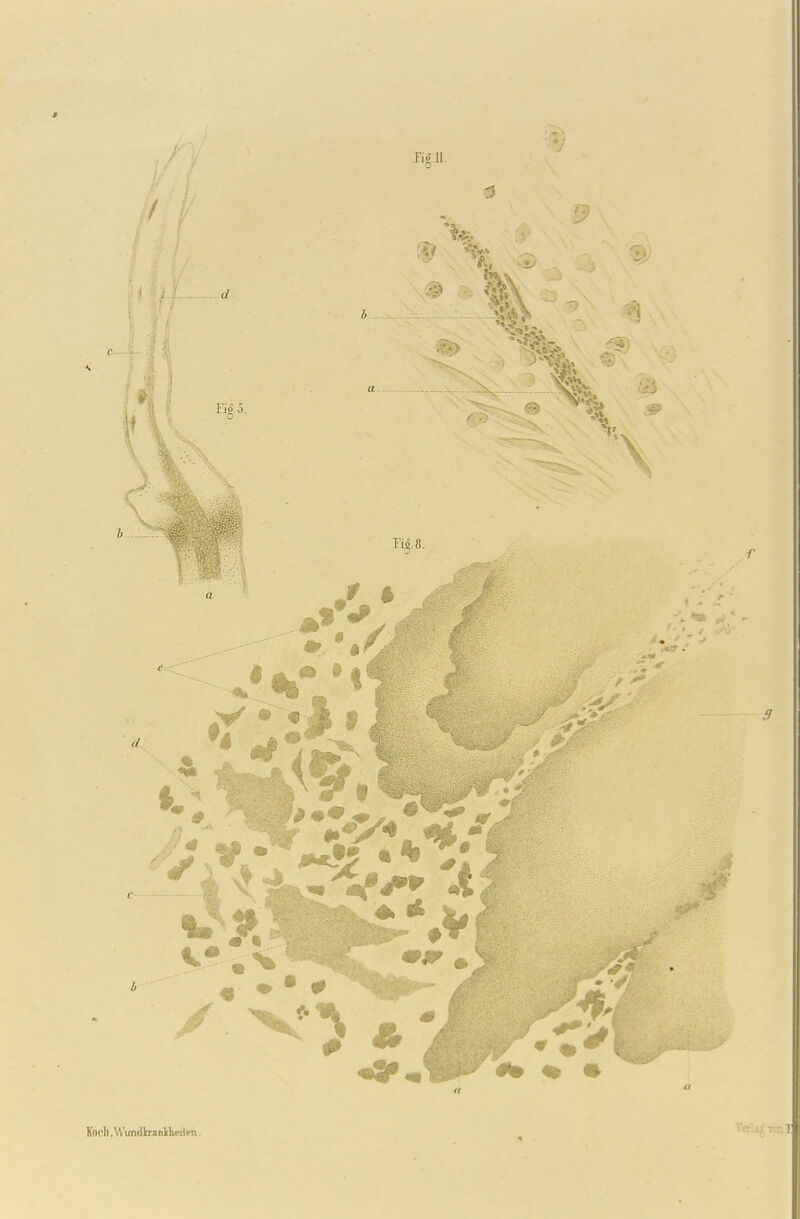 * Koch .W'undlraiiltlivitm.