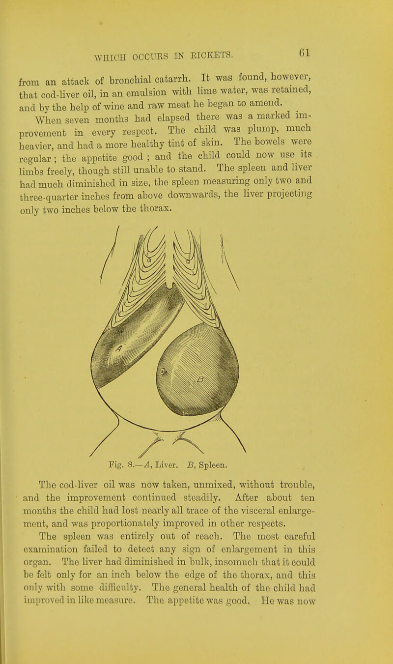 Gl from an attack of bronchial catarrh. It was found, however, that cod-liver oil, in an emulsion with lime water, was retained, and by the help of wine and raw meat he began to amend. When seven months had elapsed there was a marked im- provement in every respect. The child was plump, much heavier, and had a more healthy tint of skin. The bowels were regular ; the appetite good ; and the child could now use its limbs freely, though still unable to stand. The spleen and liver had much diminished in size, the spleen measuring only two and three-quarter inches from above downwards, the liver projecting only two inches below the thorax. The cod-liver oil was now taken, unmixed, without trouble, and the improvement continued steadily. After about ten months the child had lost nearly all trace of the visceral enlarge- ment, and was proportionately improved in other respects. The spleen was entirely out of reach. The most careful examination failed to detect any sign of enlargement in this organ. The liver had diminished in bulk, insomuch that it could be felt only for an inch below the edge of the thorax, and this only with some difficulty. The general health of the child had improved in like measure. The appetite was good. He was now Fig. 8.—A, Liver. B, Spleen.