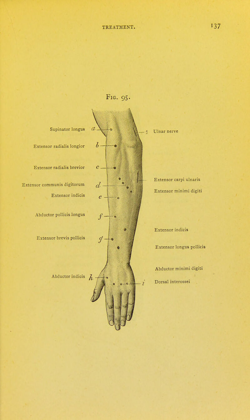 Fig. 95. Supinator longUB CL o /A, Extensor radialis longior L— \ Ulnar nerve Extensor radialis brevior Extensor communis digitorum ^ . Extensor indicis Extensor carpi ulnaris Extensor minimi digiti Abductor pollicis longus Extensor brevis pollicis (j. Abductor indicis ^ . Extensor indicis Extensor longus pollicis Abductor minimi digiti Dorsal interossei