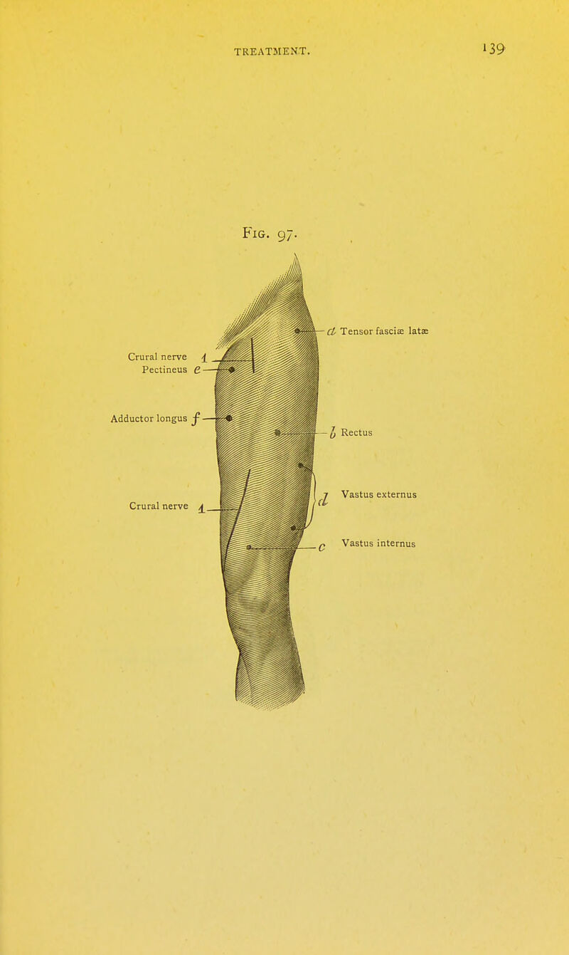 Fig. 97. Crural nerve Pectineus C. Adductor longus ^ Crural nerve ^ Ci Tensor fasciae latse J, Rectu Vastus externus Vastus internus