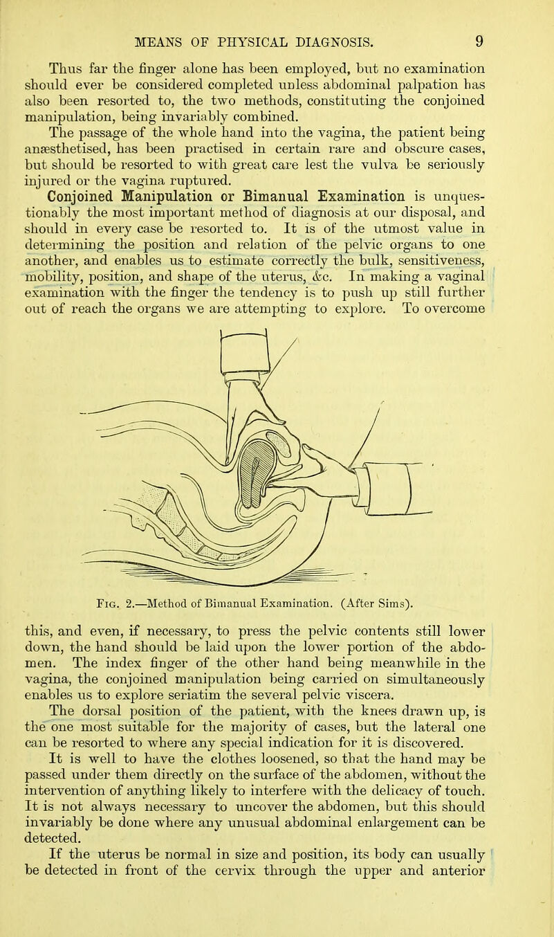 Thus far the finger alone has been employed, but no examination should ever be considered completed unless abdominal palpation lias also been resorted to, the two methods, constitviting the conjoined manipulation, being invariably combined. The passage of the whole hand into the vagina, the patient being anaesthetised, has been practised in certain I'are and obscure cases, but shoiTld be resorted to with great care lest the vulva be seriously injured or the vagina ruptured. Conjoined Manipulation or Bimanual Examination is unques- tionably the most important method of diagnosis at our disposal, and should in every case be resorted to. It is of the utmost value in deteimining the position and relation of the pelvic organs to one another, and enables us to estimate correctly the bulk, sensitiveness, mobility, position, and shape of the uterus, (fee. In making a vaginal examination with the fingei- the tendency is to push up still further out of reach the organs we are attempting to exploic. To overcome Fig. 2.—Method of Bimanual Examination. (After Sims). this, and even, if necessary, to press the pelvic contents still lower down, the hand should be laid upon the lower portion of the abdo- men. The index finger of the other hand being meanwhile in the vagina, the conjoined manipulation being carried on simultaneously enables us to explore seriatim the several pelvic viscera. The dorsal position of the patient, with the knees drawn up, is the one most suitable for the majority of cases, but the lateral one can be resorted to where any special indication for it is discovered. It is well to have the clothes loosened, so that the hand may be passed under them directly on the smface of the abdomen, without the intervention of anything likely to interfere with the delicacy of touch. It is not always necessary to uncover the abdomen, but this should invariably be done where any unusual abdominal enlargement can be detected. If the uterus be normal in size and position, its body can usually be detected in front of the cervix through the upper and anterior