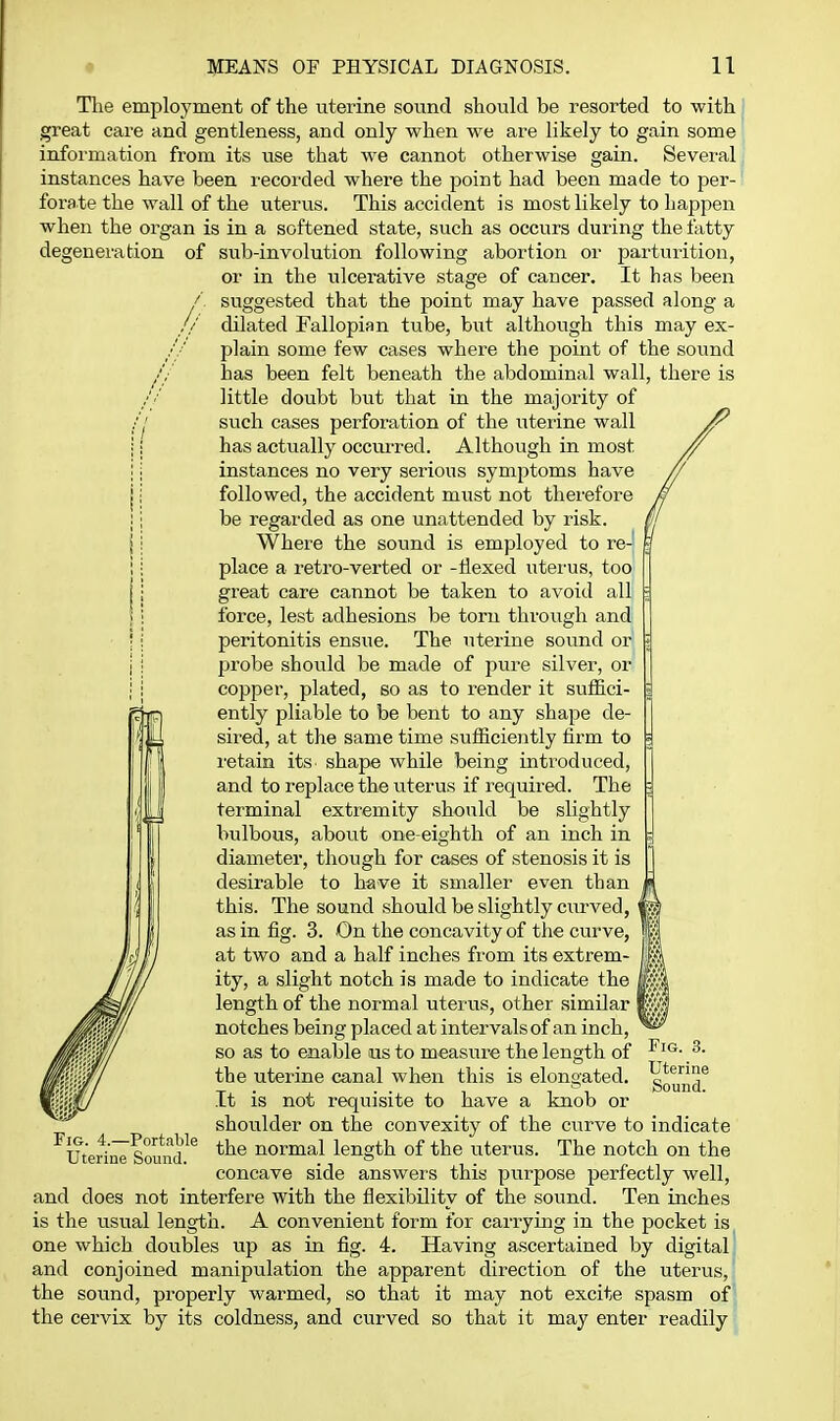 The employment of the uterine sound should be resorted to with great care and gentleness, and only when we are likely to gain some information from its use that we cannot otherwise gain. Several instances have been recorded where the point had been made to per- forate the wall of the uterus. This accident is most likely to happen when the organ is in a softened state, such as occurs during the tatty degeneration of sub-involution following abortion or parturition, or in the ulcerative stage of cancer. It has been suggested that the point may have passed along a dilated Fallopian tube, but although this may ex- plain some few cases where the point of the sound has been felt beneath the abdominal wall, there is little doubt but that in the majority of such cases perforation of the uterine wall has actually occmxed. Although in most instances no very serious symptoms have followed, the accident must not thei'efore be regarded as one unattended by risk. Where the sound is employed to re- place a retro-verted or -flexed uterus, too great care cannot be taken to avoid all force, lest adhesions be torn through and peritonitis ensue. The uterine sound or probe shoiild be made of pure silver, or copper, plated, so as to render it suffici- ently pliable to be bent to any shape de- sired, at the same time sufficiently firm to retain its shape while being introduced, and to replace the uterus if required. The terminal extremity should be slightly bulbous, abovit one-eighth of an inch in diameter, though for cases of stenosis it is desirable to have it smaller even than this. The sound should be slightly curved, as in fig. 3. On the concavity of the curve, at two and a half inches from its extrem- ity, a slight notch is made to indicate the length of the normal uterus, other similar | notches being placed at intervals of an inch, so as to enable us to measure the length of the uterine canal when this is elongated. It is not requisite to have a knob or shoulder on the convexity of the curve to indicate the normal length of the uterus. The notch on the concave side answers this purpose perfectly well, and does not interfere with the flexibility of the sound. Ten inches is the usual length. A convenient form for carrying in the pocket is one which doubles up as in fig. 4. Having ascertained by digital and conjoined manipulation the apparent direction of the uterus, the sound, properly warmed, so that it may not excite spasm of the cervix by its coldness, and curved so that it may enter readily Fig. 3. Uterine Sound. Fig. 4.—Portable Uterine Sound.
