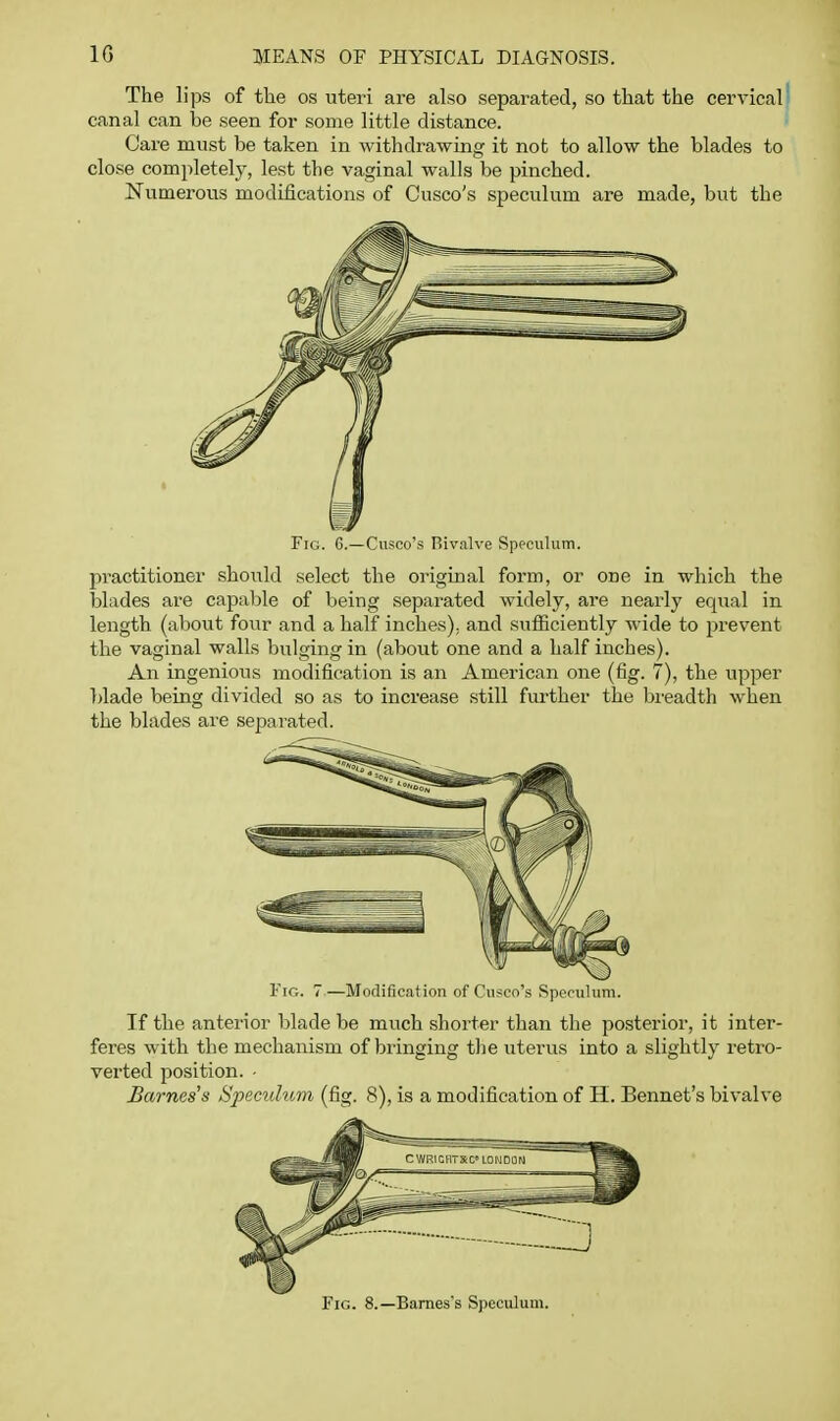 The lips of the os uteri are also separated, so that the cervical' canal can be seen for some little distance. Care must be taken in withdrawing it not to allow the blades to close completely, lest the vaginal walls be pinched. Numerous modifications of Cusco's speculum are made, but the Fig. 6.—Cvisco's Bivalve Speculum. practitioner should select the original form, or one in which the blades are capable of being separated widely, are nearly equal in length (about four and a half inches); and sufficiently wide to prevent the vaginal walls bulging in (about one and a half inches). An ingenious modification is an American one (fig. 7), the upper blade being divided so as to increase still fm-ther the breadth when the blades are separated. Fig. -Modification of Cusco's Speculum. If the anterior blade be much shorter than the posterior, it inter- feres with the mechanism of bringing the uterus into a slightly retro- verted position. - Barnes's Speculum (fig. 8), is a modification of H. Bennet's bivalve Fig. 8.—Barnes's Speculum.