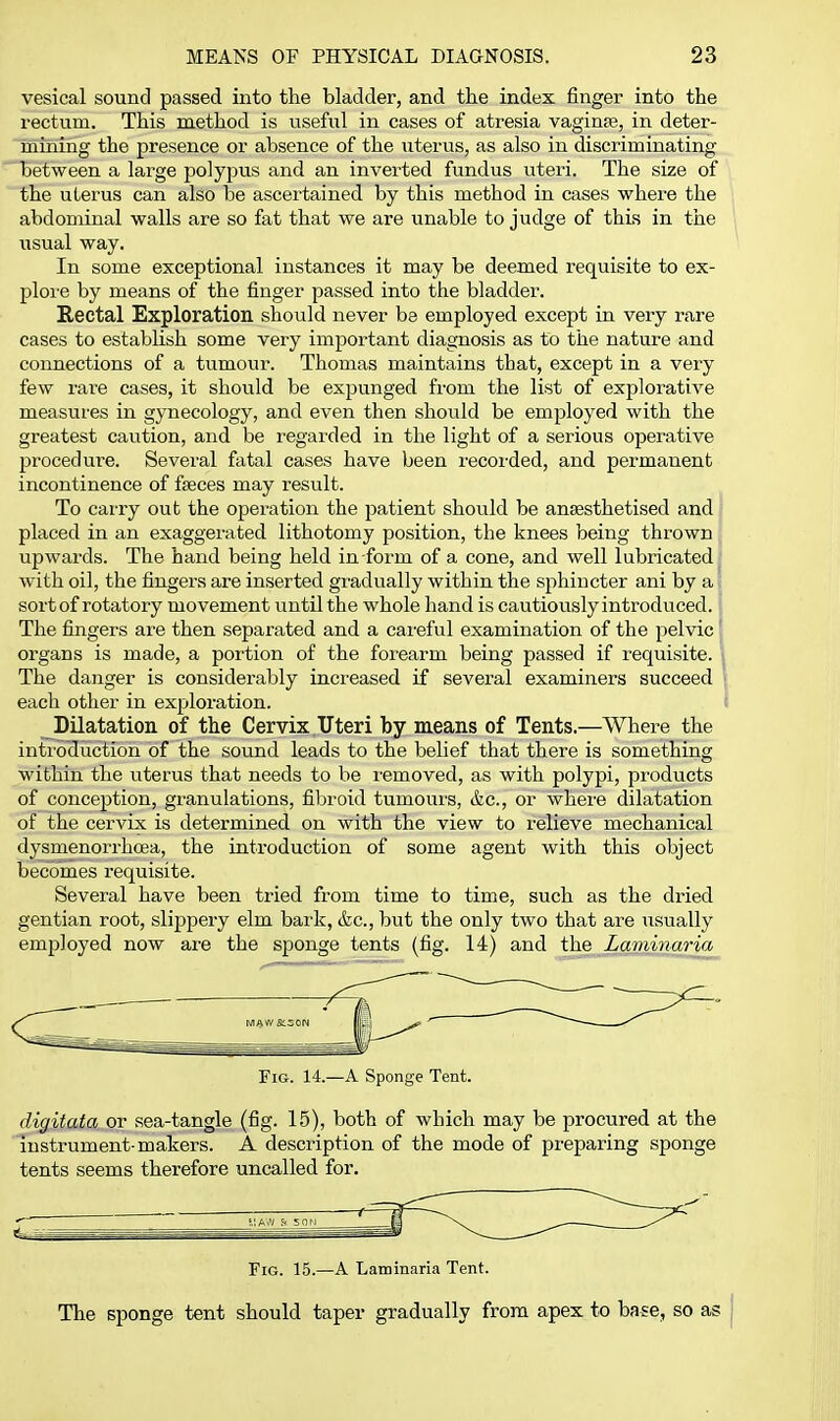 vesical sound passed into the bladder, and the index finger into the rectum. This method is viseful in cases of atresia vagiuEe, in deter- mining the presence or absence of the uterus, as also in discriminating between a large polypus and an inverted fundus uteri. The size of the uterus can also be ascertained by this method in cases where the abdominal walls are so fat that we are unable to judge of this in the usual way. In some exceptional instances it may be deemed requisite to ex- ploie by means of the finger passed into the bladder. Rectal Exploration should never be employed except in very rare cases to establish some very important diagnosis as to the nature and connections of a tumour. Thomas maintains that, except in a very few rare cases, it should be expunged from the list of explorative measures in gynecology, and even then should be employed with the greatest caution, and be regarded in the light of a serious operative procedure. Several fatal cases have been recorded, and permanent incontinence of faeces may result. To carry out the operation the patient should be anaesthetised and placed in an exaggerated lithotomy position, the knees being thrown upwards. The hand being held in form of a cone, and well lubricated with oil, the fingers are inserted gradually within the sphincter ani by a; sort of rotatory movement until the whole hand is cautiously introduced. The fingers are then separated and a careful examination of the pelvic' organs is made, a portion of the forearm being passed if requisite, i The danger is considerably increased if several examiners succeed i each other in exploration. t Dilatation of the Cervix Uteri by means of Tents.—Where the introduction of the sound leads to the belief that there is something within the uterus that needs to be removed, as with polypi, products of conception, granulations, fibroid tumours, <fec., or where dilatation of the cervix is determined on with the view to relieve mechanical dysmenorrhoea, the introduction of some agent with this object becomes requisite. Several have been tried from time to time, such as the dried gentian root, slippery elm bark, &c., but the only two that are usually employed now are the sponge tents (fig. 14) and the^aminaria Fig. 14.—a Sponge Tent. digitata or sea-tangle (fig. 15), both of which may be procured at the instrument-makers. A description of the mode of preparing sponge tents seems therefore uncalled for. Fig. 15.—A Laminaria Tent. The sponge tent should taper gradually from apex to base, so as {