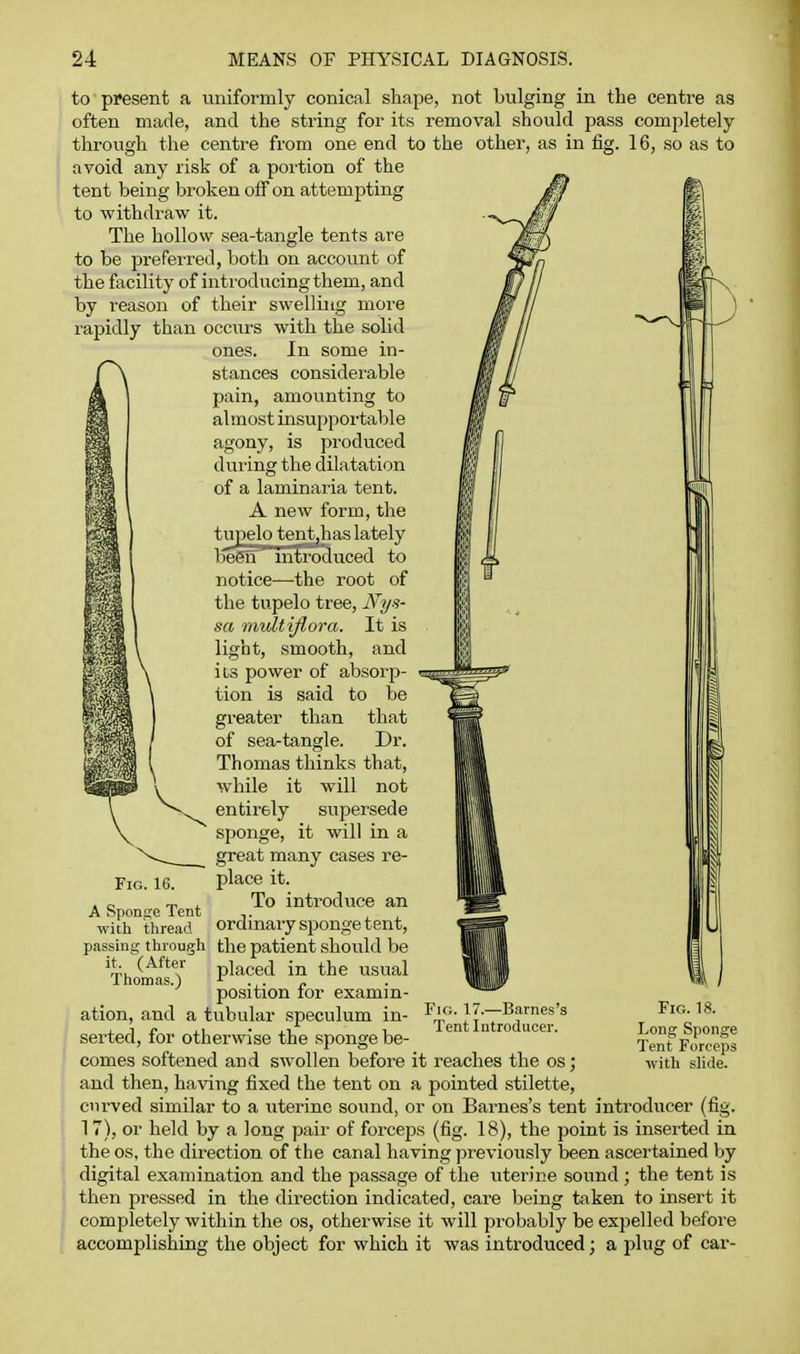 Fig. 16. A Sponge Tent with thread passing through the patient should be ^hu placed in the usual Thomas.) ^ .,. o position tor examm- to present a uniformly conical shape, not bulging in the centre as often made, and the string for its removal should pass completely- through the centre from one end to the other, as in fig. 16, so as to avoid any risk of a poition of the tent being broken off on attempting to withdraw it. The hollow sea-tangle tents are to be preferred, both on account of the facility of inti'oducingthem, and by reason of their swelling more rapidly than occurs with the solid ones. In some in- stances considerable pain, amounting to almost insupportable agony, is produced during the dilatation of a laminaria tent. A new form, the tupelo tent,has lately been introduced to notice—the root of the tupelo tree, Nys- sa multiflora. It is light, smooth, and iis power of absorp- tion is said to be greater than that of sea-tangle. Dr. Thomas thinks that, while it will not entirely supersede sponge, it will in a great many cases re- place it. To introduce an ordinary sponge tent. Fig. 17.—Barnes's Tent Introducer. Fig. 18. Long Sponge Tent Forceps with slide. ation, and a tubular speculum in- serted, for otherwise the sponge be- comes softened and swollen before it reaches the os; and then, having fixed the tent on a pointed stilette, curved similar to a uterine sound, or on Barnes's tent introducer (fig. 17), or held by a long pair of forceps (fig. 18), the point is inserted in the OS, the direction of the canal having previously been ascertained by digital examination and the passage of the uterine sound ; the tent is then pressed in the direction indicated, care being taken to insert it completely within the os, otherwise it will probably be expelled before accomplishing the object for which it was introduced; a plug of car-
