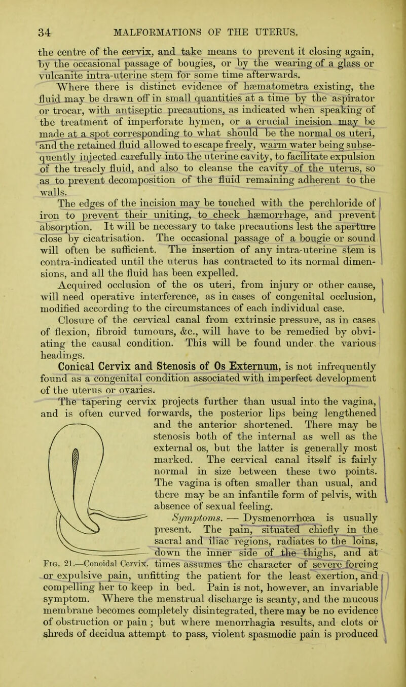 the centre of tlie cervix, and take means to prevent it closing again, by tlie occasional passage of bougies, or by the wearing of a glass or vulcanite intra-uterine stem for some time afterwards. Where there is distinct evidence of heematometra existing, the fluid may be drawn off in small quantities at a time by the aspirator or trocar, with antiseptic precautions, as indicated when speaking of the treatment of imperforate hymen, or a crucial incision may be made at.a spot cori'esponding to what should be the normal os uteri, and the retained fluid allowed to escape freely, w^rm waterjjeing subse- quently injected carefully into the uterine cavity, to facilitate expulsion of the treacly fluid, and also to cleanse the cavity of the uterus, so as to prevent decomposition of the fluid remaining adherent to the ■walls. The edges of the incision may be toxiched with the perchloride of ( iron to prevent theii- uniting, to check hsemorihage, and prevent j absorption. It will be necessary to take precautions lest the aperture ! close by cicatrisation. The occasional passage of a bougie or sound | will often be suflicient. The insertion of any intra-uterine stem is I contra-indicated until the uterus has contracted to its normal dimen- I sions, and all the fluid has been expelled. Acquired occlusion of the os uteri, from injury or other cause, will need operative interference, as in cases of congenital occlusion, modified according to the circumstances of each individual case. Closuie of the cervical canal from extiinsic pressure, as in cases of flexion, fibroid tumours, <fec., will have to be remedied by obvi- ating the causal condition. This will be found xmder the various headings. Conical Cervix and Stenosis of Os Externum, is not infrequently found as a congenital condition associated with imperfect development of the uterus or ovaries. The tapering cervix projects further than usual into the vagina, and is often curved forwards, the posterior hps being lengthened ^ and the anterior shortened. There may be / \ stenosis both of the internal as well as the \ I « ] external os, but the latter is generally most i / marked. The cei'vical canal itself is fairly \ / normal in size between these two points. The vagina is often smaller than usual, and there may be an infantile form of pelvis, with absence of sexual feeling. Symptoms. — Dysmenorrhoea is usually present. The pain,' situated chiefly in the sacral and iliac i-egions, radiates to the loins, down the inner side of the thighs, aiiH at Fig. 21.—Conoidal Cervix, times assumes the character of severe.forcing - or expulsive pain, unfitting the patient for the least exertion, and comjjelling her to keep in bed. Pain is not, however, an invariable symptom. Where the menstrual discharge is scanty, and the mucous membrane becomes completely disintegrated, there may be no evidence of obstruction or pain ; but where menoiThagia results, and clots or shreds of decidua attempt to pass, violent spasmodic pain is produced