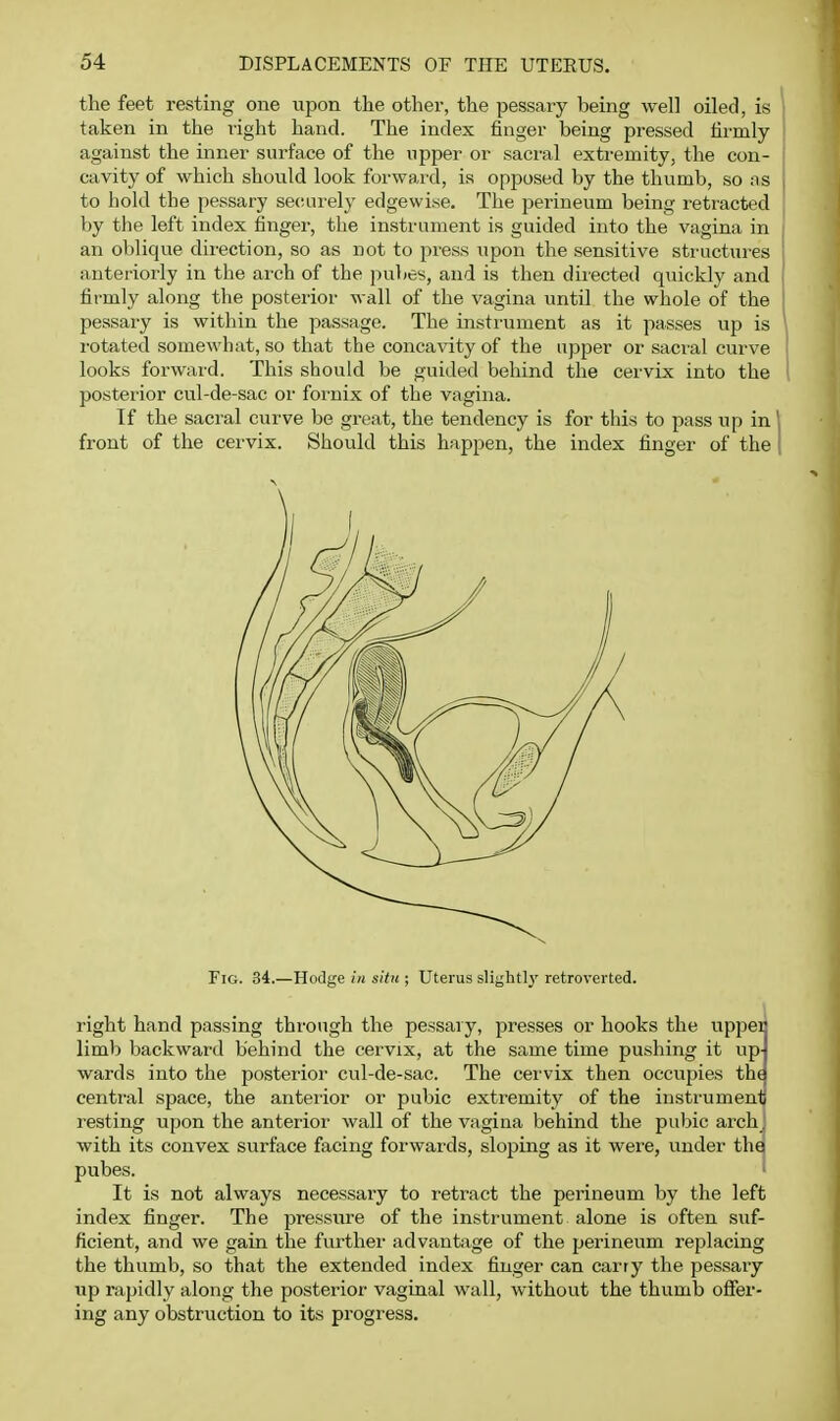 the feet resting one upon the other, the pessary being well oiled, is taken in the light hand. The index finger being pressed firmly against the mner surface of the upper or sacral extremity, the con- cavity of which should look forward, is opposed by the thumb, so ns to hold the pessary seciLii-ely edgewise. The perineum being retracted by the left index finger, the instrument is guided into the vagina in an ol)lique direction, so as not to press upon the sensitive sti-uctures anteriorly in the ai'ch of the pubes, and is then directed quickly and firmly along the posterior wall of the vagina until the whole of the pessary is within the passage. The instrument as it passes up is I'otated somewhat, so that the concavity of the upper or saci'al curve looks forward. This should be guided behind the cervix into the posterior cul-de-sac oi' foi-nix of the vagina. If the sacral curve be gi'eat, the tendency is for this to pass up in front of the cervix. Should this happen, the index finger of the Fig. 34.—Hodge in situ ; Uterus slii^htly retroverted. right hand passing through the pessary, presses or hooks the uppei limb backward behind the cervix, at the same time pushing it up- wards into the posterior cul-de-sac. The cervix then occupies the central space, the anterior or pubic extremity of the instrumenti resting upon the anterior wall of the vagina behind the pubic arch, with its convex surface facing forwards, sloping as it were, under tha pubes. ' It is not always necessary to retract the perineum by the left index finger. The pressure of the instrument alone is often suf- ficient, and we gain the further advanfcige of the perineum replacing the thumb, so that the extended index finger can carry the pessary up rapidly along the posterior vaginal wall, without the thumb ofier- ing any obstruction to its progress.