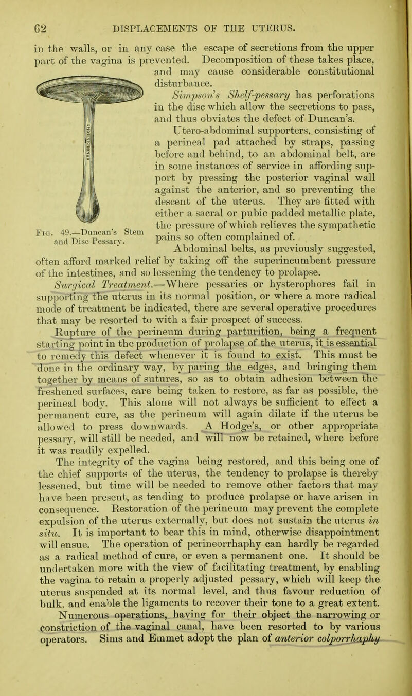 Fig. 49.—Duncan's Stem and Disc Pe.ssarv. in the walls, or in any case the escape of secretions from the upper part of the vagina is prevented. Decomposition of these takes place, and may cause considerable constitutional disturbance. Simpson's Shelf-pessary has perforations in the disc which allow the secretions to pass, and thus obviates the defect of Duncan's. Utero-abdominal supporters, consisting of a perineal pad attached by straps, passing befoi'e and behind, to an abdominal belt, are in some instances of service in affording sup- port by pi'essing the posterior vaginal wall against the anterior, and so preventing the descent of the uterus. They are fitted with either a sacral or pubic padded metallic plate, the pressure of which relieves the sympathetic pains so often complained of. Abdominal belts, as previously suggested, often affoi'd marked relief by taking off the superincumbent pressuie of the intestines, and so lessening the tendency to prolapse. Surijicfd Treatment.—Where pessaries or hysterophores fail in supporting the uterus in its normal position, or where a more radical mode of treatment be indicated, there are several operative procedures that may be resorted to with a fair prospect of success. Rupture of the perineum during parturition, being a frequent starting point in the production of prolapse of the uterus, it is essential to remedy this defect whenever it is found to exist. This must be done in the ordinary way, by paring the edges, and bringing them together by means of sutures, so as to obtain adhesion between the fi-eshened surfaces, care being taken to restore, as far as possible, the perineal body. This alone will not always be sufficient to effect a permanent cure, as the perineum will again dilate if the uterus be allowed to press downwards. A Hodge's, or other appropriate pessaiy, will still be needed, and will now be retained, where befoi-e it was readily expelled. The integrity of the vagina being restored, and this being one of the chief suppoits of the uterus, the tendency to prolapse is thereby lessened, but time will be needed to remove other factors that may have been present, as tending to produce prolapse or have arisen in consequence. Restoi'ation of the perineum may prevent the complete expulsion of the uterus externally, but does not sustain the uterus in situ. It is important to bear this in mind, otherwise disappointment will ensue. The operation of perineorrhaphy can hardly be regarded as a radical method of cure, or even a permanent one. It should be undertaken more with the view of facilitating treatment, by enabling the vagina to retain a properly adjusted pessary, which will keep the titerus suspended at its normal level, and thus favour reduction of bulk, and enable the ligaments to recover their tone to a great extent. Numerous operations, having for their object the narrowing or constriction of the vaginal canal, have been resorted to by various operators. Siuis and Emmet adopt the plan of anterior colpqrr/iaftkj/-