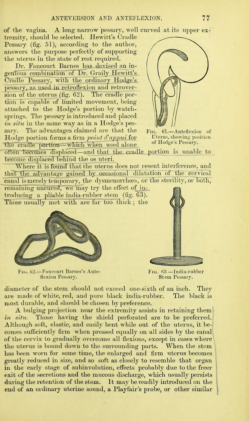 of the vagina. A long narrow pessary, well cui-ved at its upper ex- tremity, should be selected. Hewitt's Cradle Pessary (fig. 51), according to the author, answers the purpose perfectly of supporting the uterus in the state of rest requii'ed. Dr. Fancourt Bai-nes has devised an in- genious combination of Dr. Graily Hewitt's Ci-adle Pessary, with the ordinary Hodge's pessaiy, as used in retroflexion and retrover- sion of the uterus (fig. 62). The cradle por- tion is capable of limited movement, being attached to the Hodge's portion by watch- springs. The pessary is introduced and placed in situ in the same way as in a Hodge's pes- sary. The advantages claimed ai'e that the Hodge portion forms a tii'm point d'aj^pui for the cradle portion—whicli when used alone often becomes'~displaced—and that the cradle portion is unable to become displaced behind the os uteri. Where it is found that the uterus does not resent interference, and tha't' the advantage gained by occasional dilatation of the cervical canal is merely temporary, the dysmenorrhcea, or the sterility, or both, remaining uncm-ed,' we may ti-y the effect of_^iu- troducing a pliable india-rubber stem (fig. 63). Those usually met with are far too thick; the Fig. 61.—Anteflexion of Uferus, showing position of Hodge's Pessary. «1) FiLi. (i2.— Fancourt Barnes's Ante- flexion Pessary. Fig. 'i3—India-rubber Stem Pessary. diameter of the stem should not exceed one-sixth of an inch. They ai'e made of white, red, and pare black india-rubber. The black is most diirable, and should be chosen by preference. A bulging projection near the extremity assists in retaining themi in situ. Those having the shield perforated are to be preferred.' Although soft, elastic, and easily bent while out of the uterus, it be- comes sufficiently firm when pressed equally on all sides by the canal of the cervix to gradually ovei-come all flexions, except in cases whei-e the uterus is bound down to the surrounding pai-ts. When the stem has been woi-n for some time, the enlarged and firm uterus becomes greatly reduced in size, and so soft as closely to resemble that organ in the early stage of subinvolution, effects probably due to the freer exit of the secretions and the mucous discharge, which usually persists during the retention of the stem. It may be readily introduced on the end of an ordinary uterine sound, a Playfair's probe, or other similar